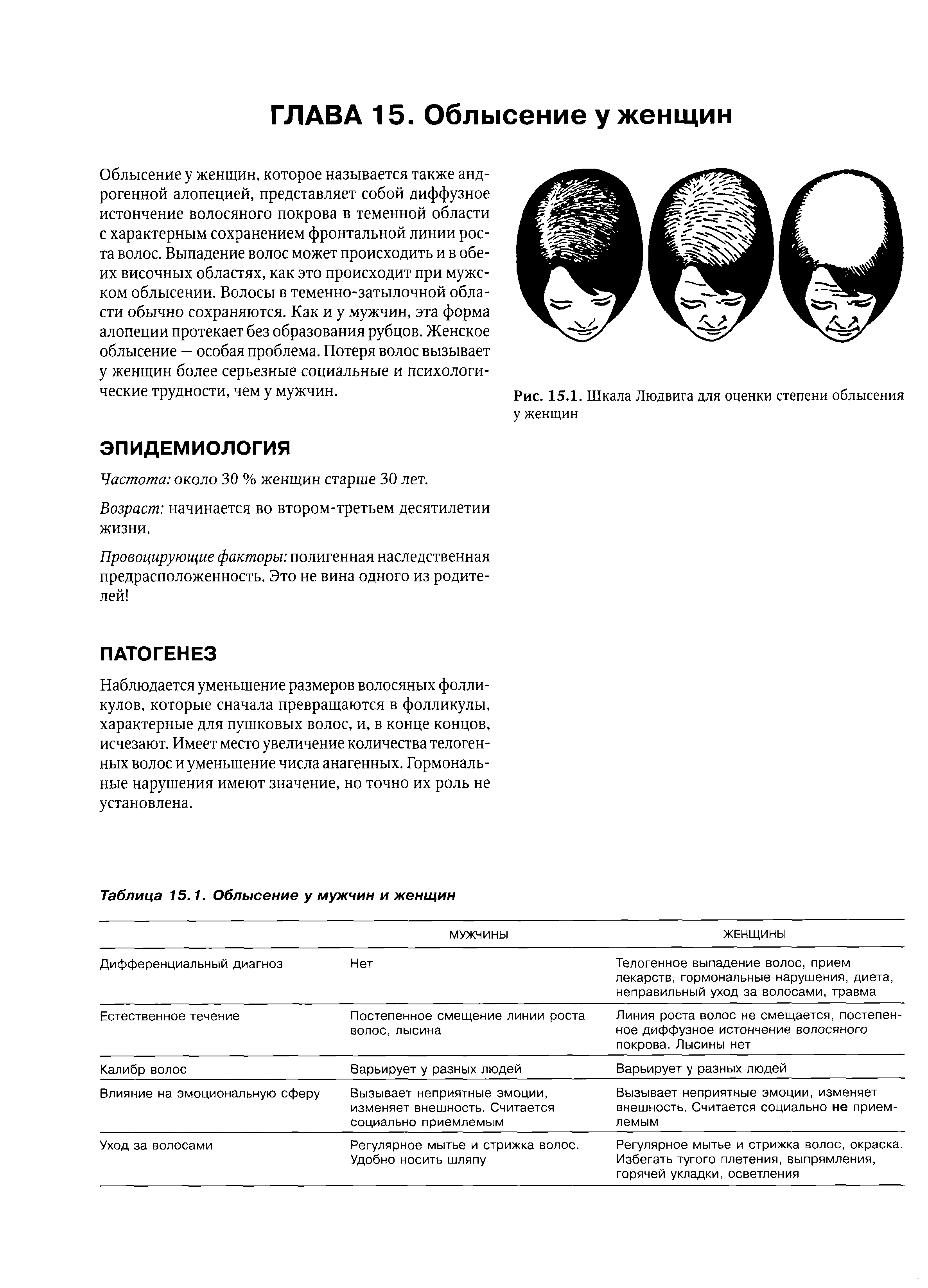 Рис. 15.1. Шкала Людвига для оценки степени облысения у женщин...