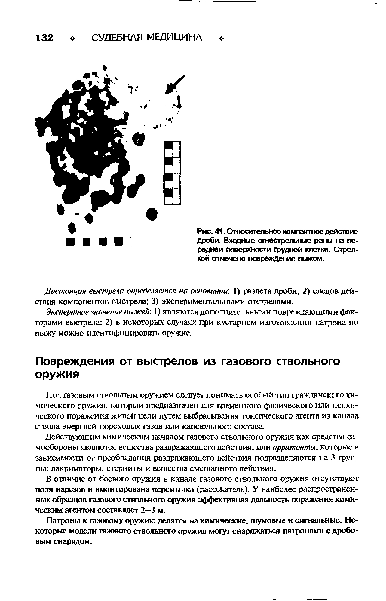 Рис. 41. Относительное компактное действие дроби. Входные огнестрельные раны на передней поверхности грудной клетки. Стрелкой отмечено повреждение пыжом.