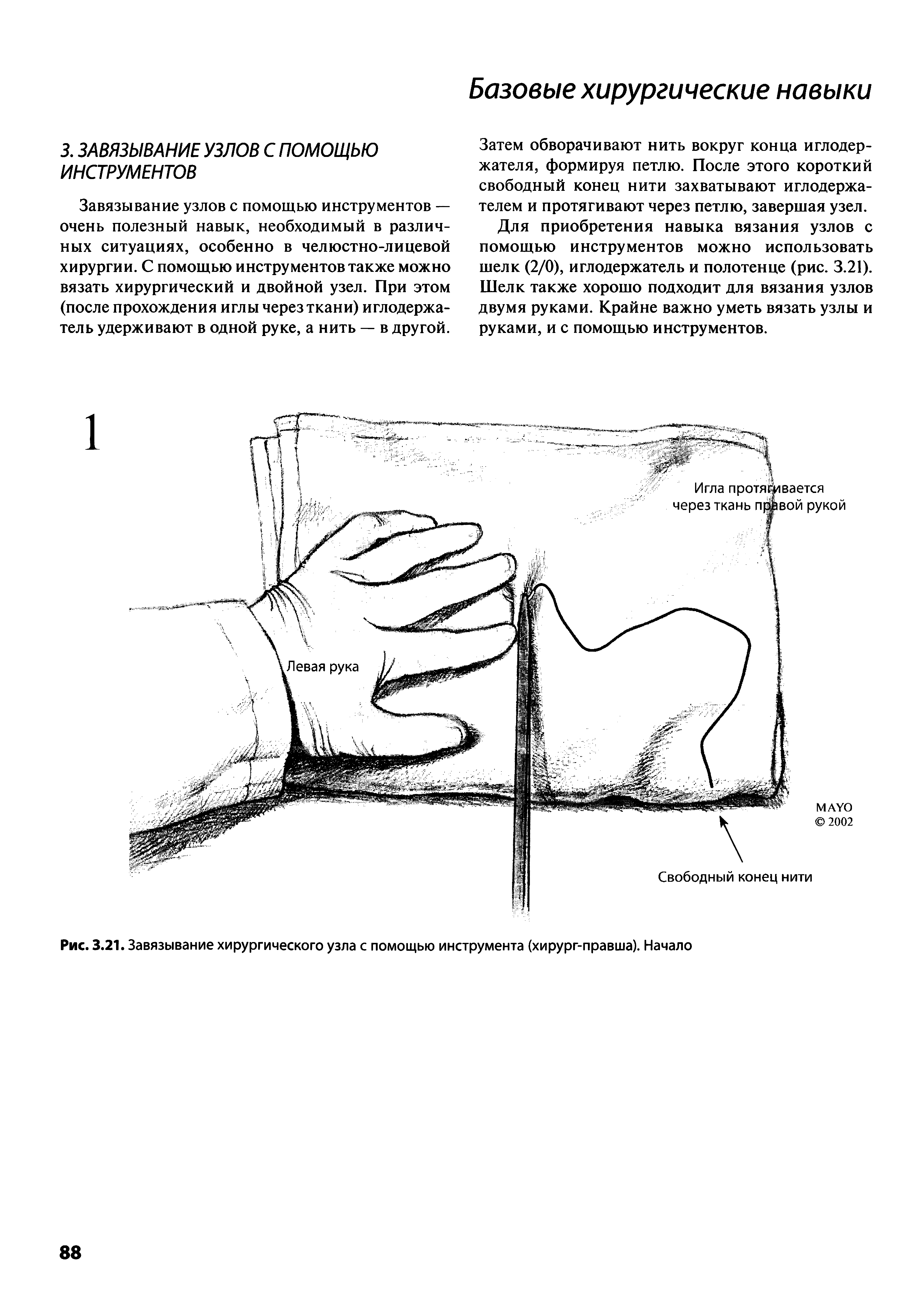 Рис. 3.21. Завязывание хирургического узла с помощью инструмента (хирург-правша). Начало...