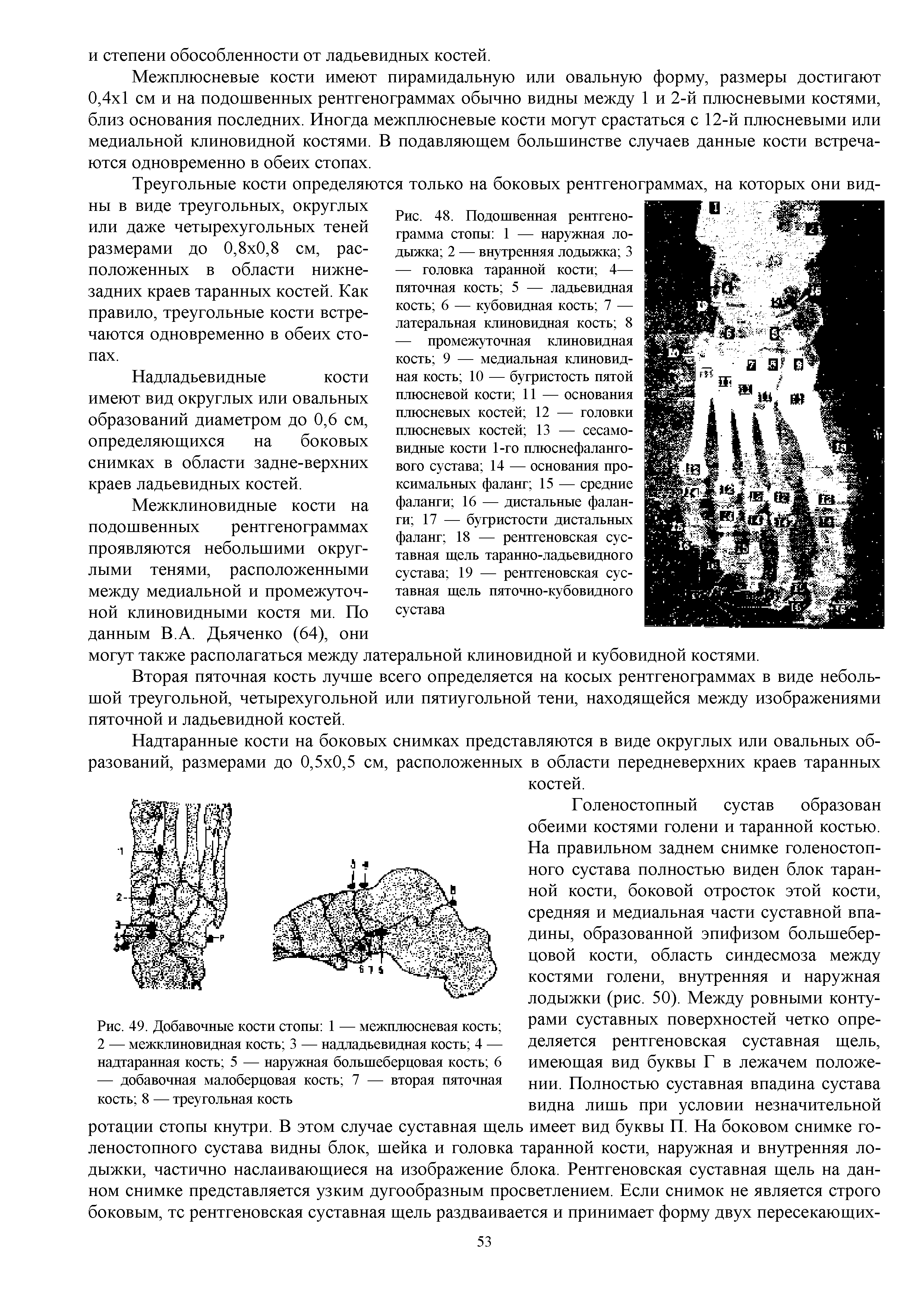 Рис. 49. Добавочные кости стопы 1 — межплюсневая кость 2 — межклиновидная кость 3 — надладьевидная кость 4 — надтаранная кость 5 — наружная большеберцовая кость 6 — добавочная малоберцовая кость 7 — вторая пяточная кость 8 — треугольная кость...