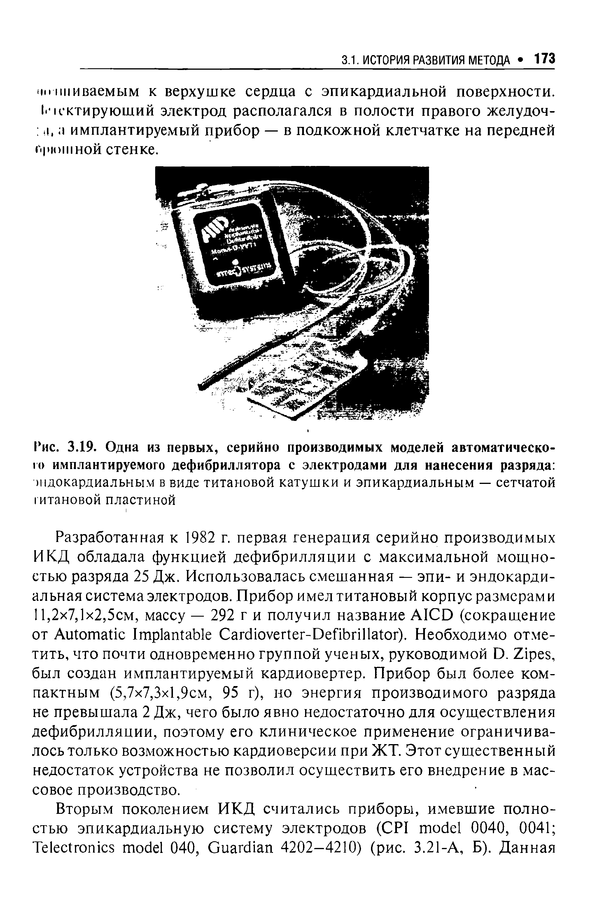 Рис. 3.19. Одна из первых, серийно производимых моделей автоматического имплантируемого дефибриллятора с электродами для нанесения разряда эндокардиальным в виде титановой катушки и эпикардиальным — сетчатой титановой пластиной...