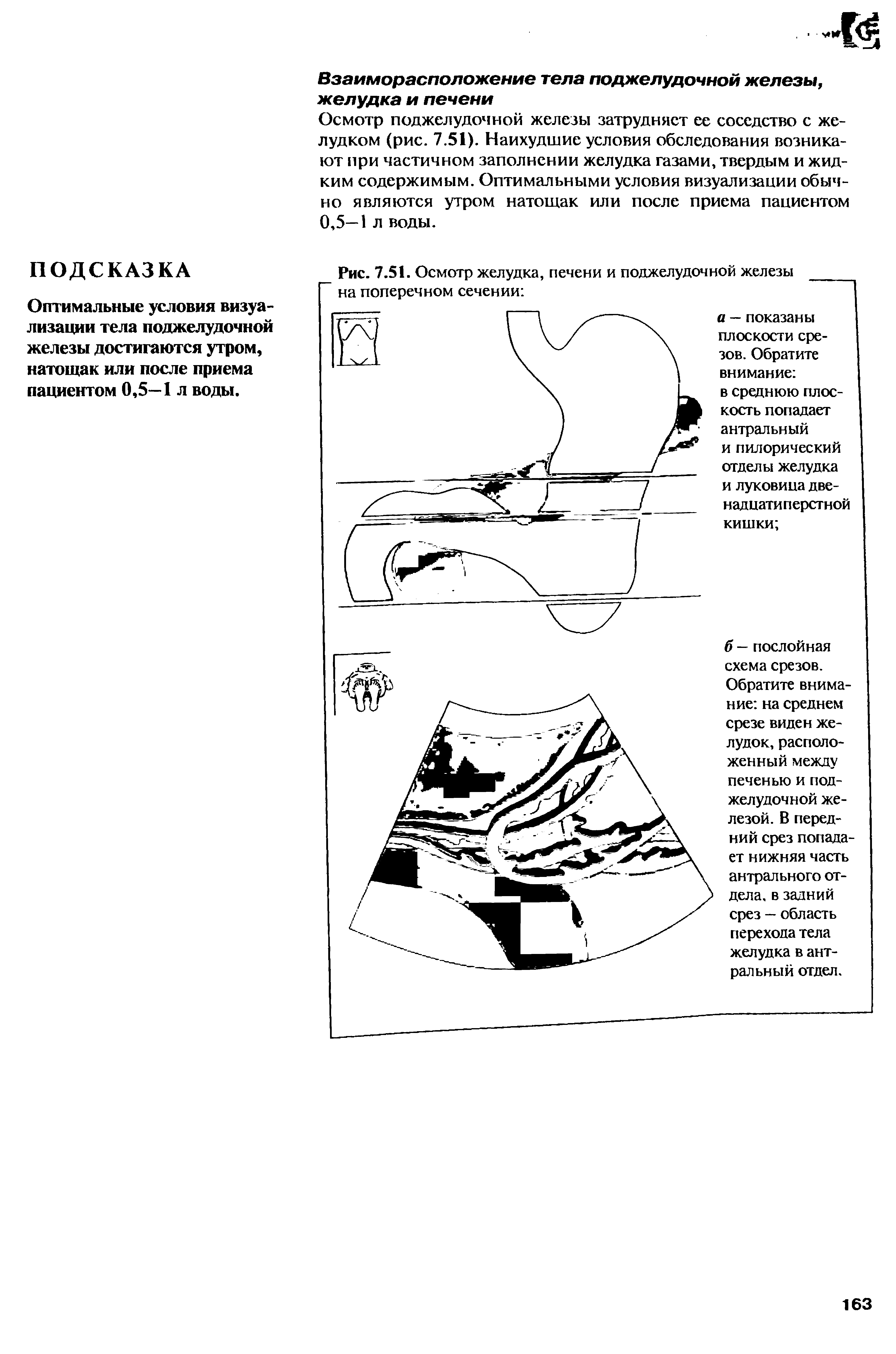 Рис. 7.51. Осмотр желудка, печени и поджелудочной железы на поперечном сечении ...