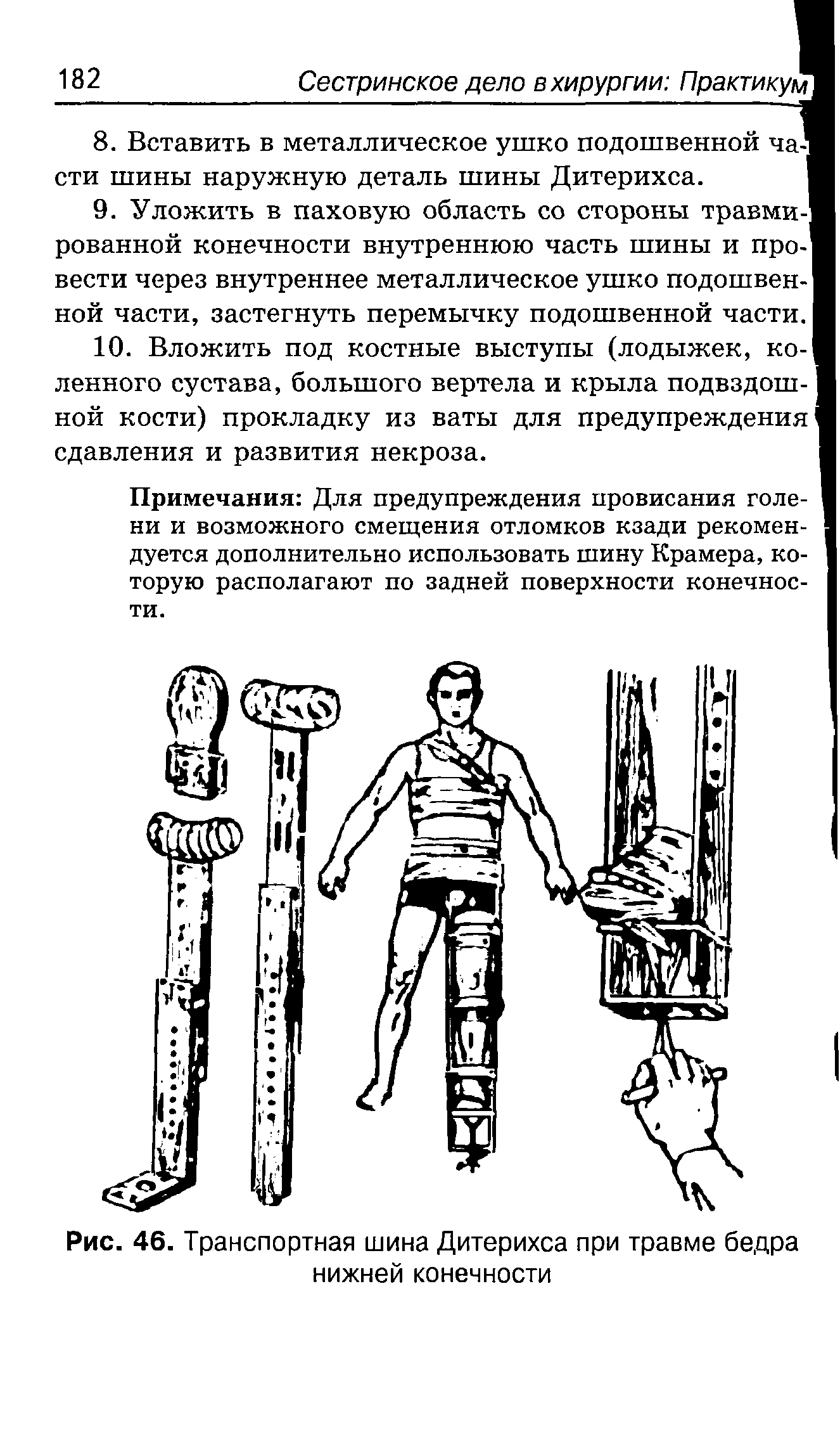 Рис. 46. Транспортная шина Дитерихса при травме бедра нижней конечности...