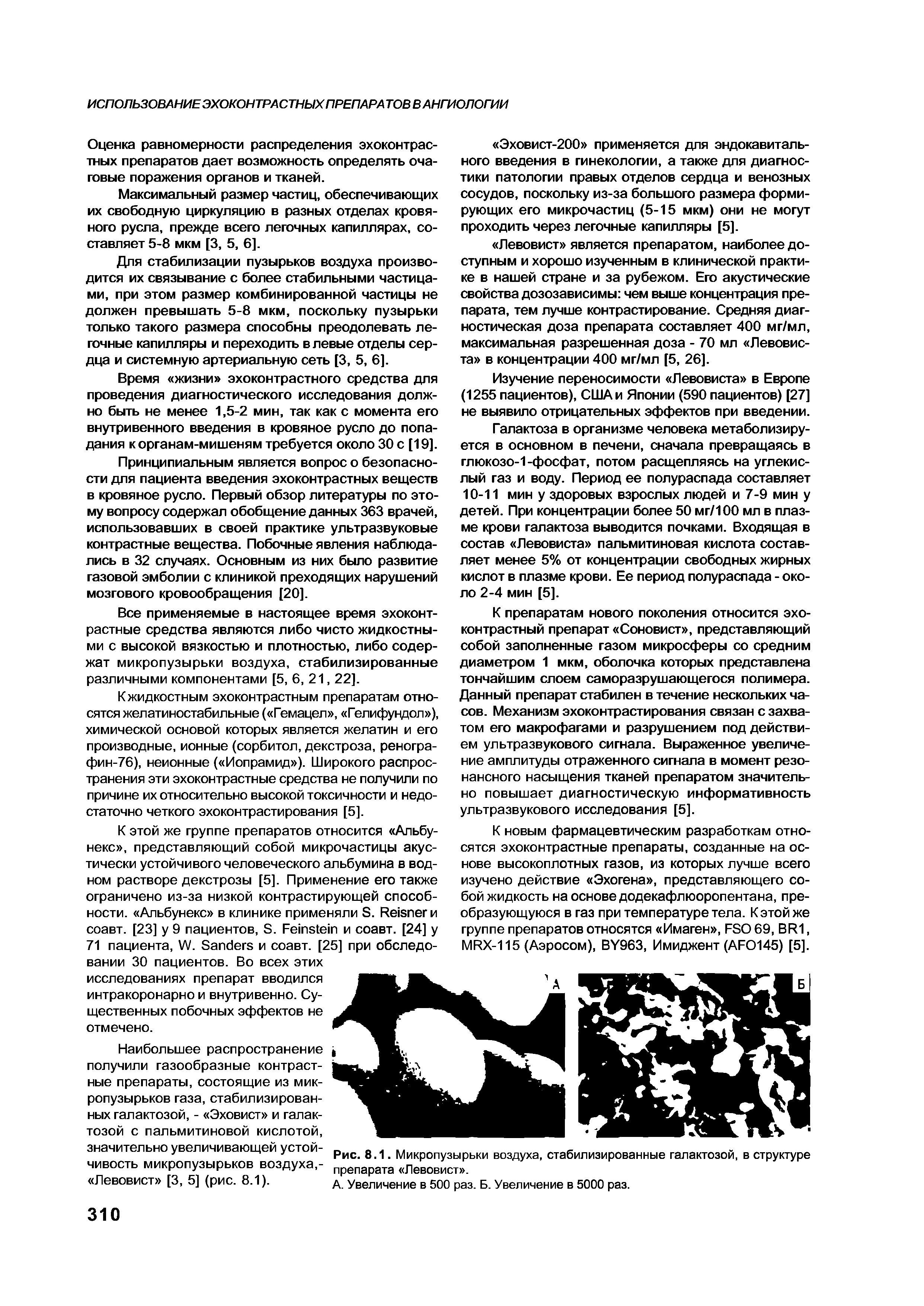 Рис. 8.1. Микропузырьки воздуха, стабилизированные галактозой, в структуре препарата Левовист .