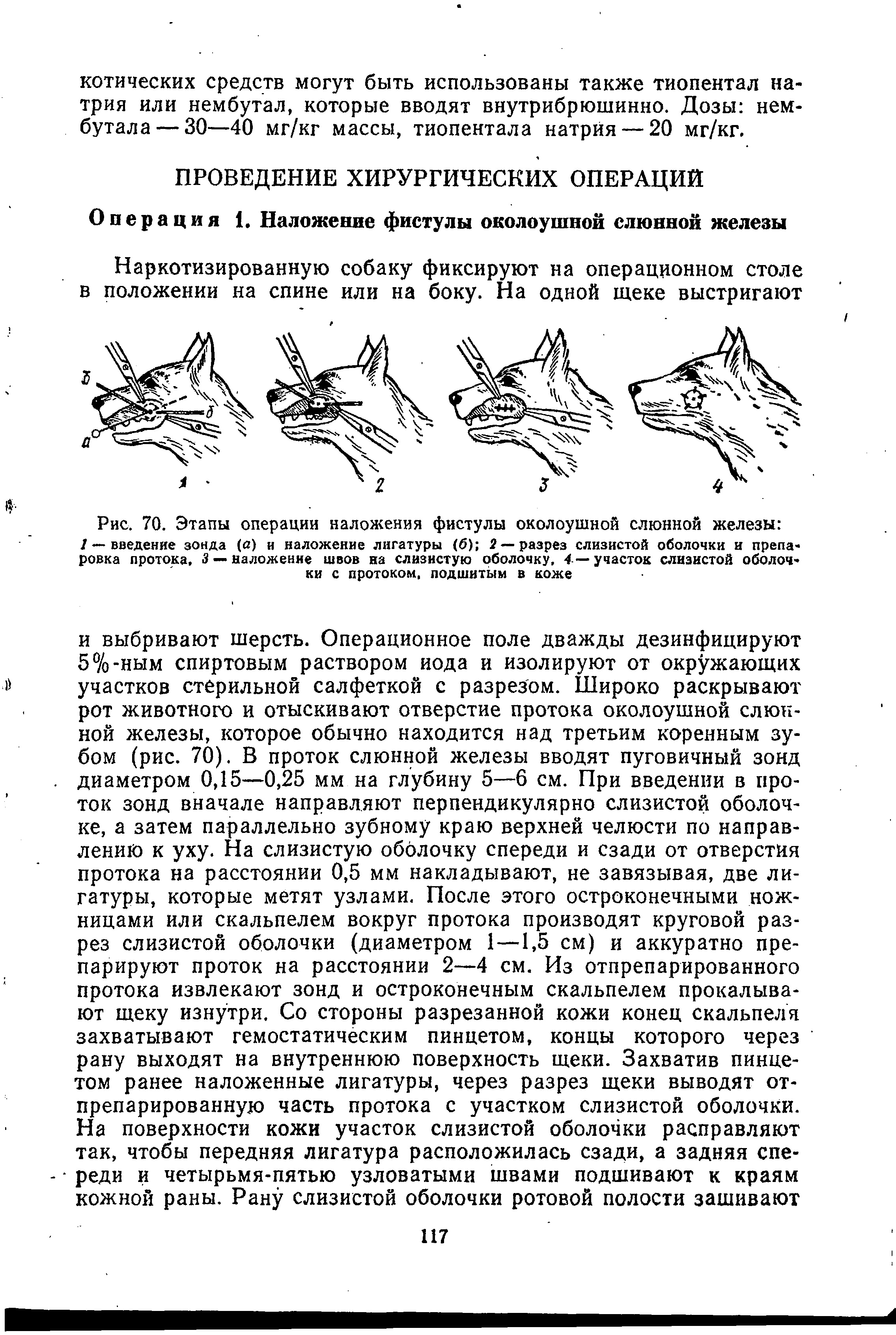 Рис. 70. Этапы операции наложения фистулы околоушной слюнной железы / — введение зонда (а) и наложение лигатуры (б) 2 — разрез слизистой оболочки и препа-ровка протока. 3 — наложение швов на слизистую оболочку, 4 — участок слизистой оболочки с протоком, подшитым в коже...