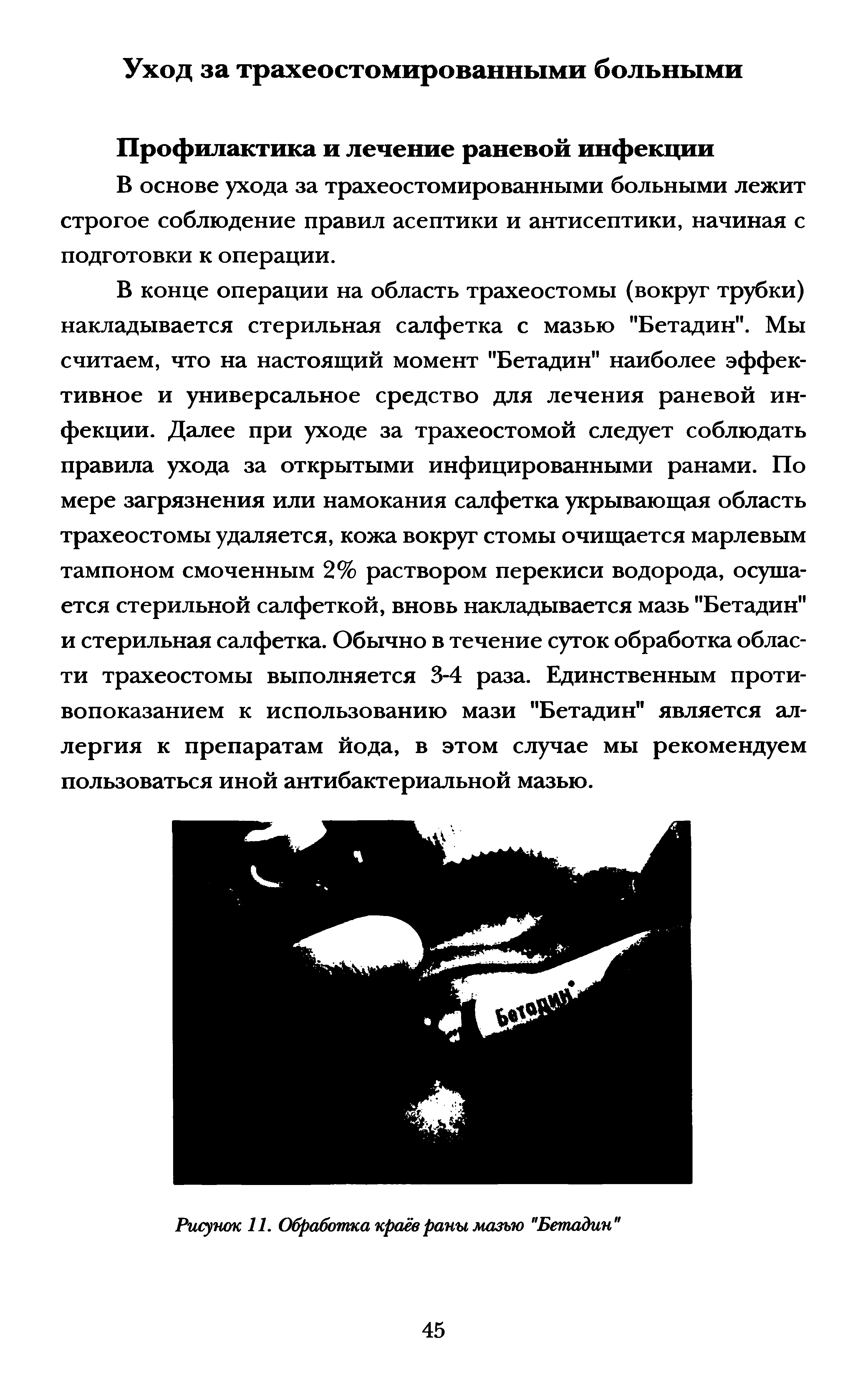 Рисунок 11. Обработка краёв раны мазью "Бетадин"...