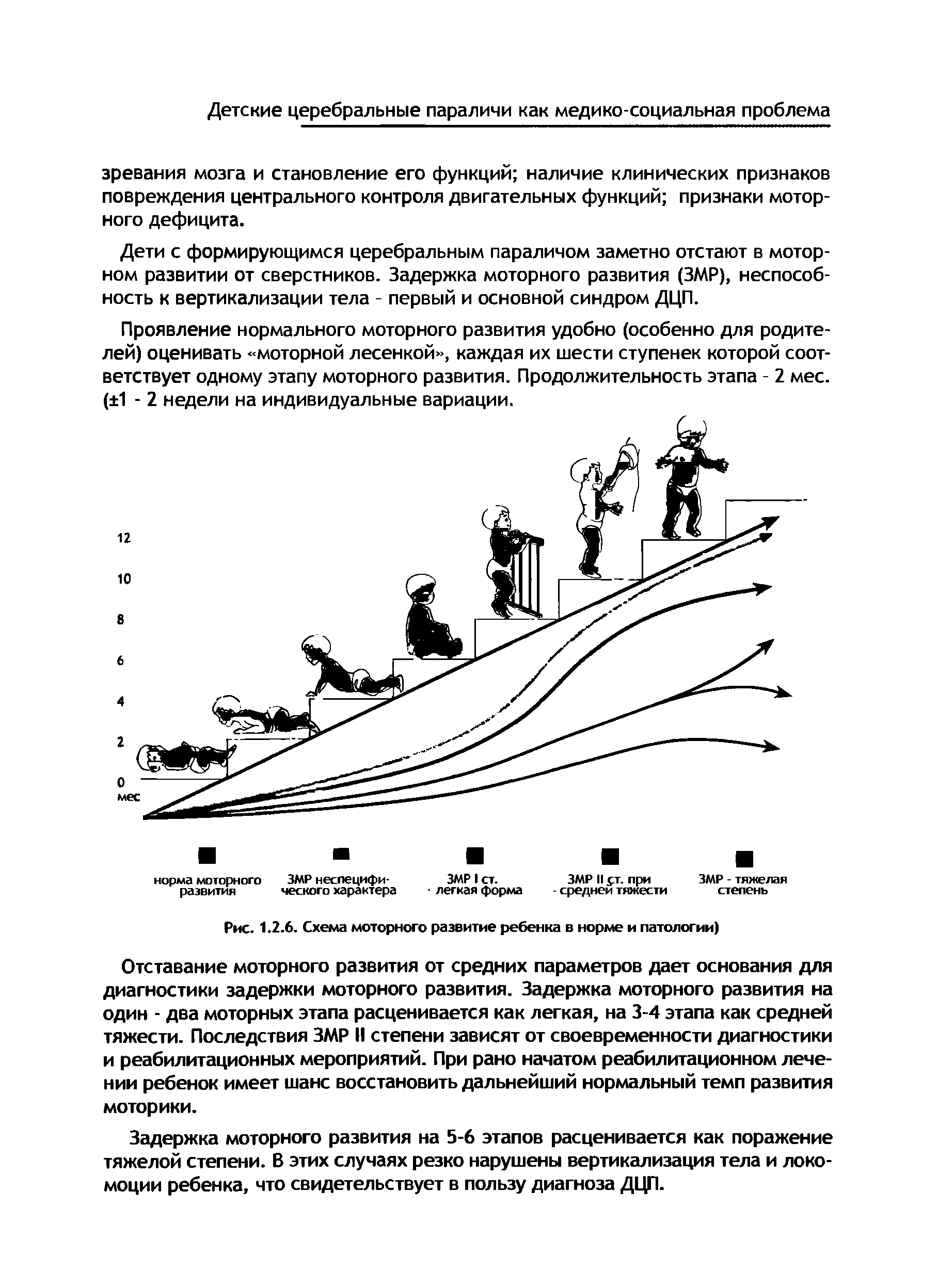 Рис. 1.2.6. Схема моторного развитие ребенка в норме и патологии)...