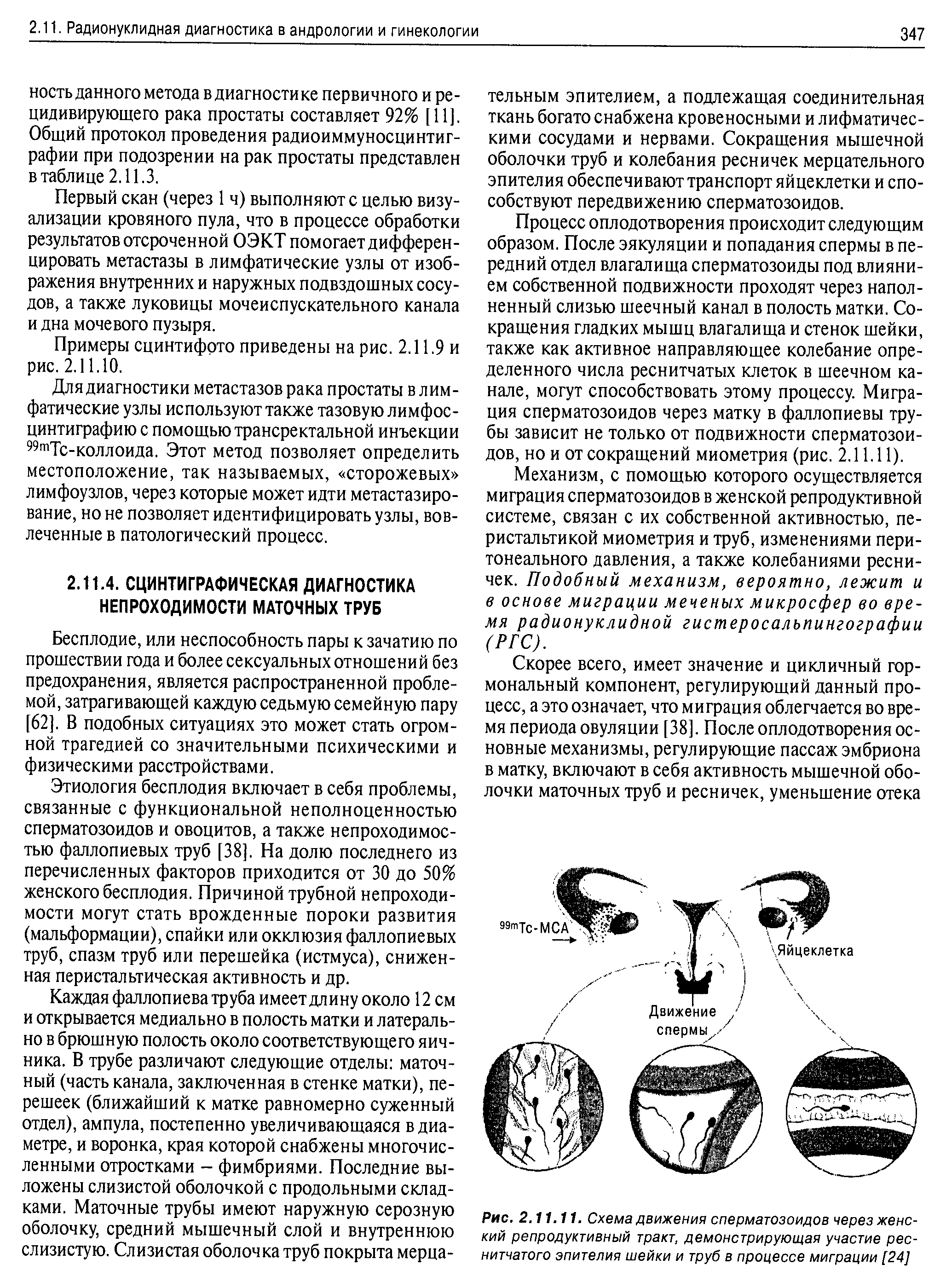 Рис. 2.11.11. Схема движения сперматозоидов через женский репродуктивный тракт, демонстрирующая участие реснитчатого эпителия шейки и труб в процессе миграции [24]...
