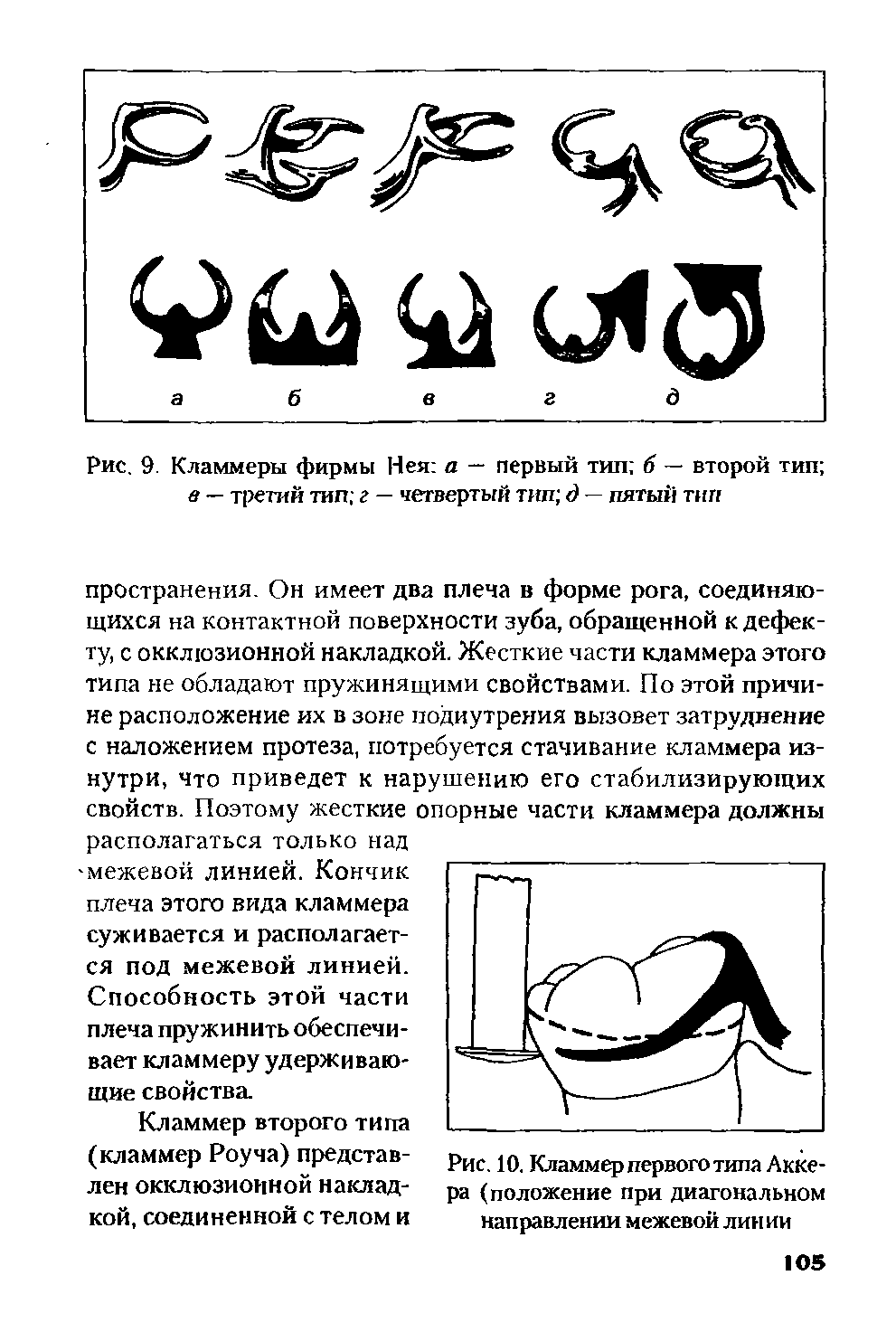 Рис. 9. Кламмеры фирмы Нея а — первый тип б — второй тип в — третий тип г — четвертый тип д — пятый тип...