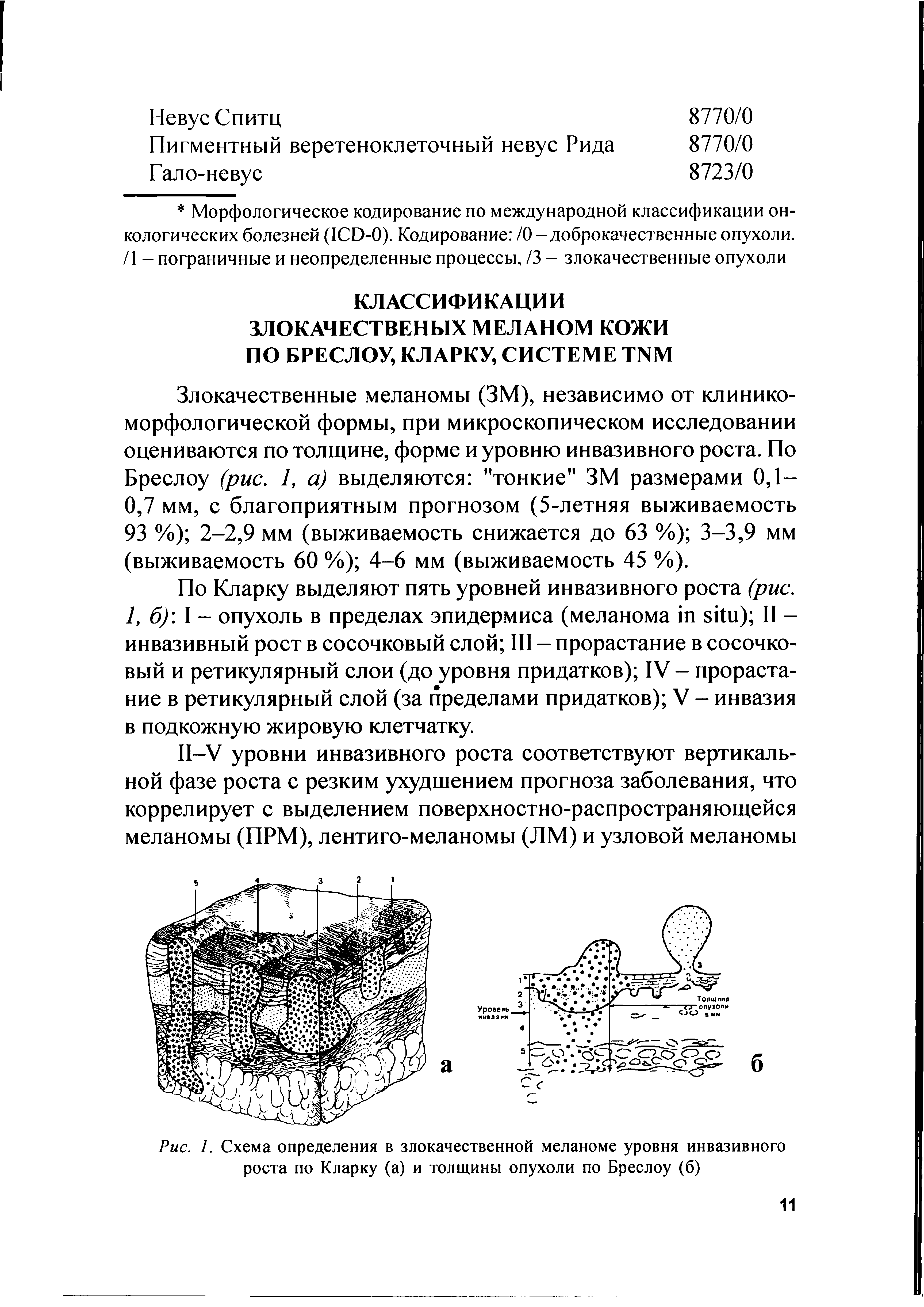 Рис. 1. Схема определения в злокачественной меланоме уровня инвазивного роста по Кларку (а) и толщины опухоли по Бреслоу (б)...