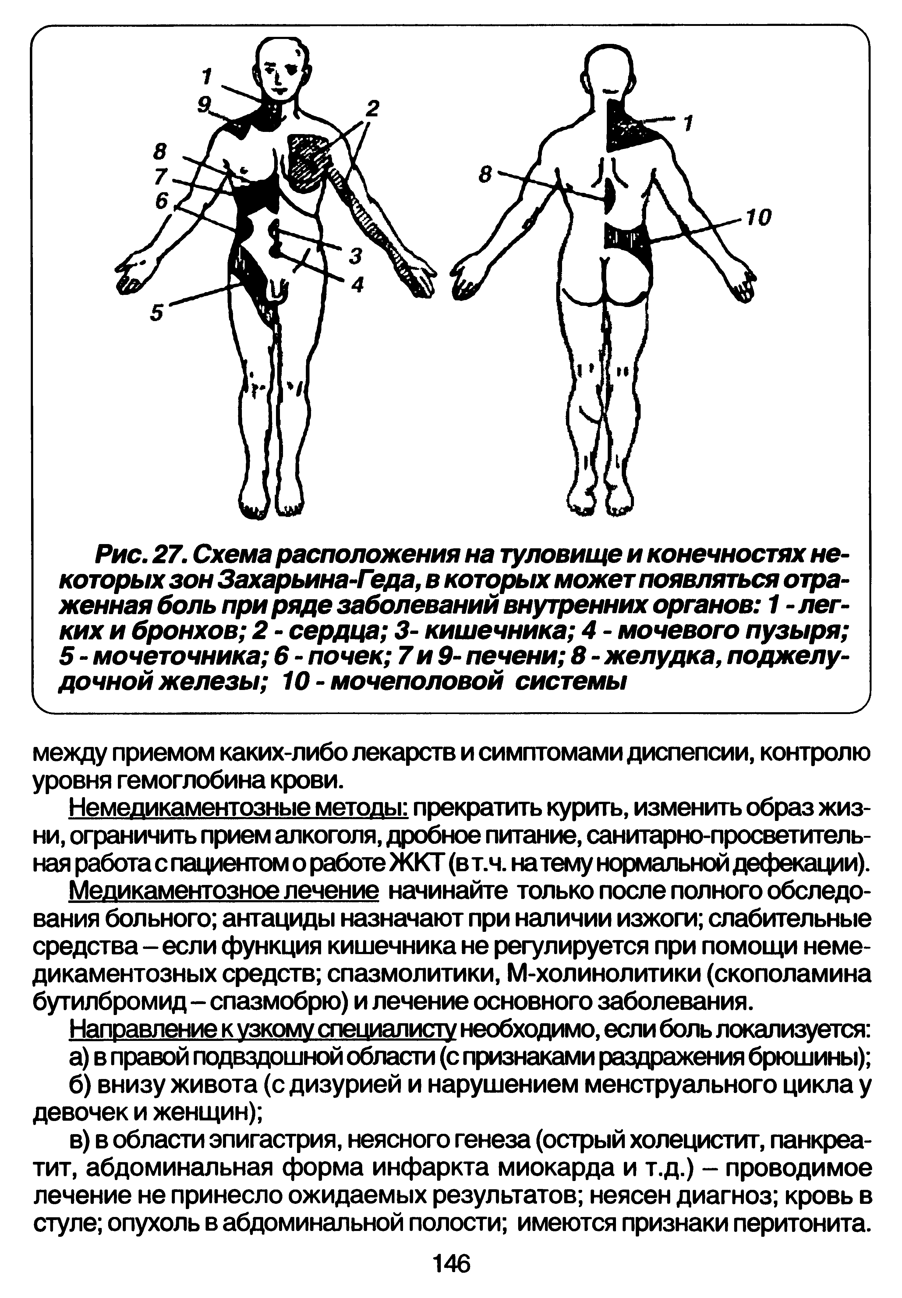 Рис. 27. Схема расположения на туловище и конечностях некоторых зон Захарьина-Гэда, в которых может появляться отраженная боль при ряде заболеваний внутренних органов 1 - легких и бронхов 2 - сердца 3- кишечника 4 - мочевого пузыря 5 - мочеточника 6 - почек 7 и 9- печени 8 - желудка, поджелудочной железы 10 - мочеполовой системы...