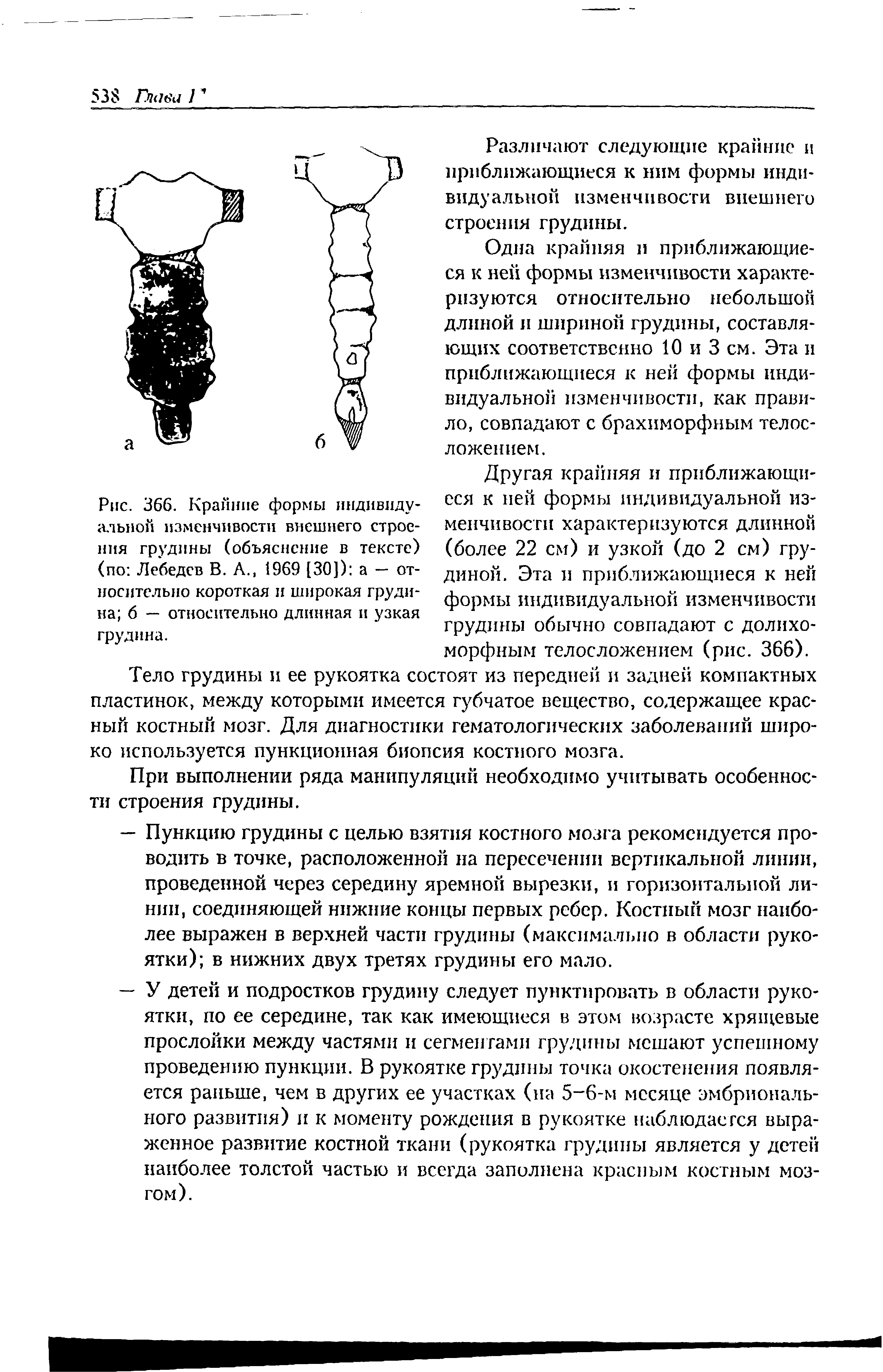 Рис. 366. Крайние формы индивидуальной изменчивости внешнего строения грудины (объяснение в тексте) (по Лебедев В. А., 1969 [30]) а — относительно короткая и широкая грудина б — относительно длинная и узкая грудина.