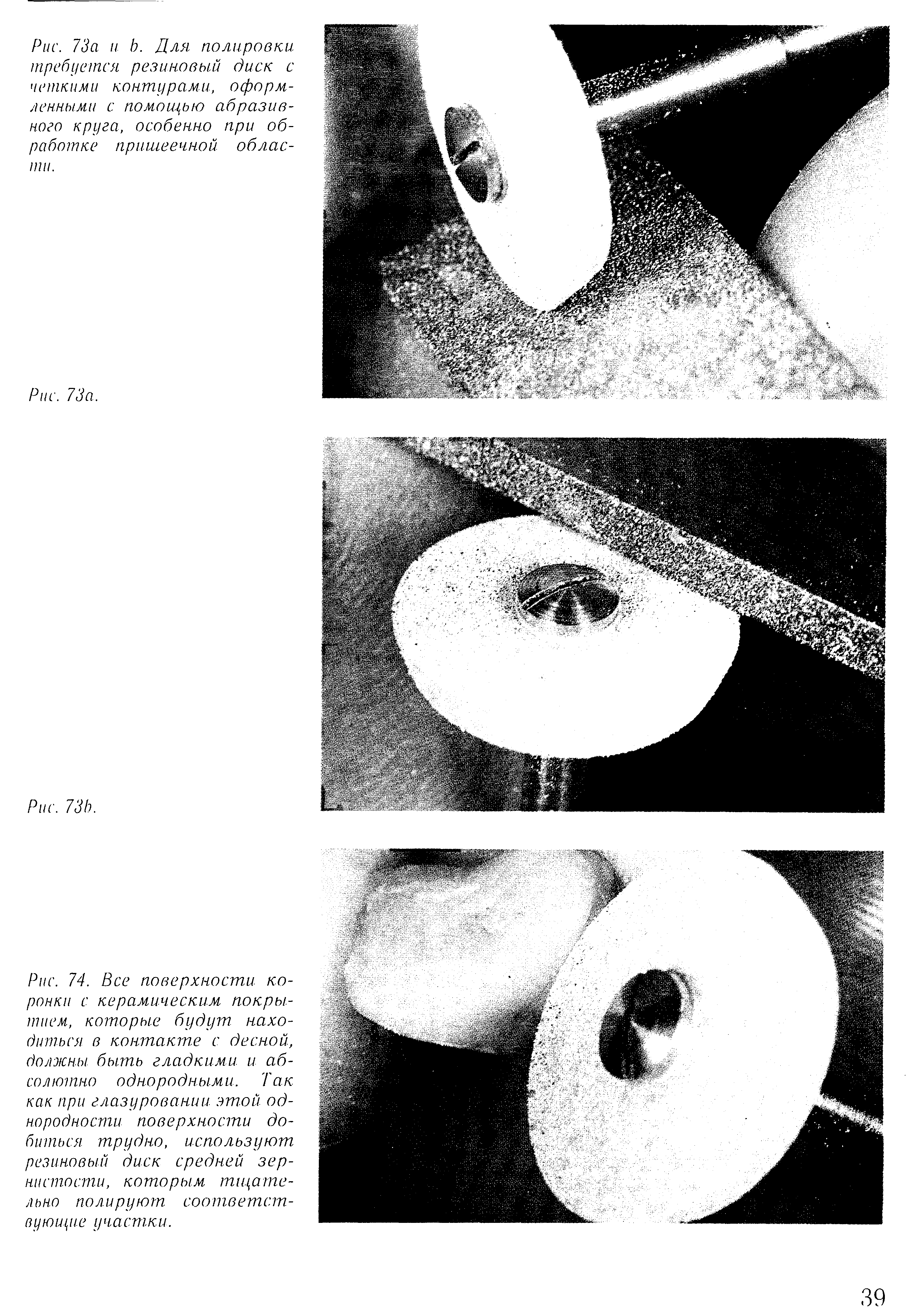 Рис. 74. Все поверхности коронки с керамическим покрытием., которые будут находиться в контакте с десной, должны быть гладкими и абсолютно однородными. Так как при глазуровании этой однородности поверхности добиться. трудно, используют резиновый диск средней зернистости, которым тщательно полируют соответствующие у ча стки.