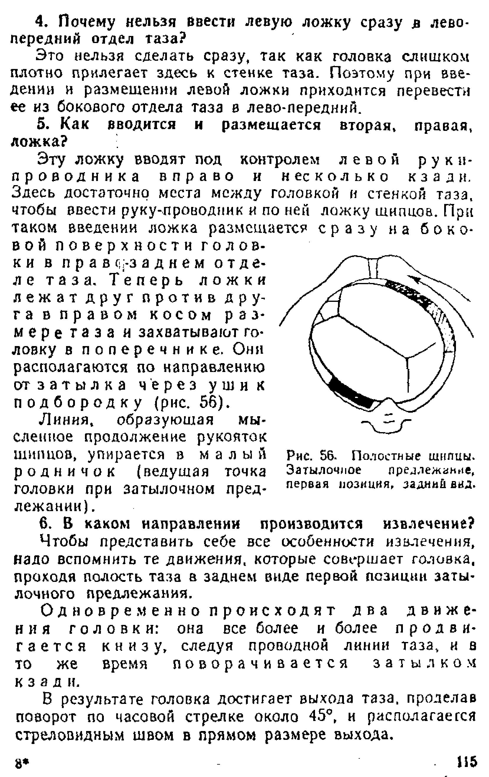 Рис. 56. Полостные щипцы. Затылочное преллежаине, первая позиция, задний вид.