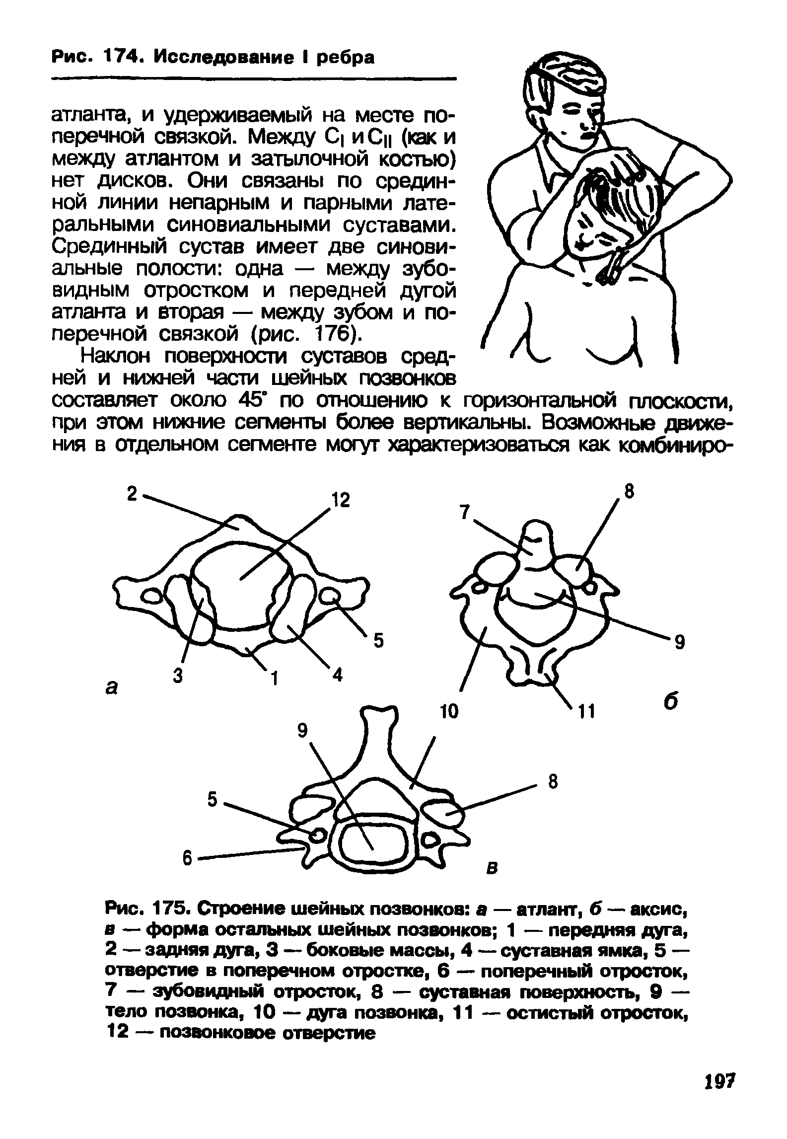 Рис. 175. Строение шейных позвонков а — атлант, б — аксис, в — форма остальных шейных позвонков 1 — передняя дуга, 2 — задняя дуга, 3 — боковые массы, 4 — суставная ямка, 5 — отверстие в поперечном отростке, 6 — поперечный отросток, 7 — зубовидный отросток, 8 — суставная поверхность, 9 — тело позвонка, 10 — дуга позвонка, 11 — остистый отросток, 12 — позвонковое отверстие...