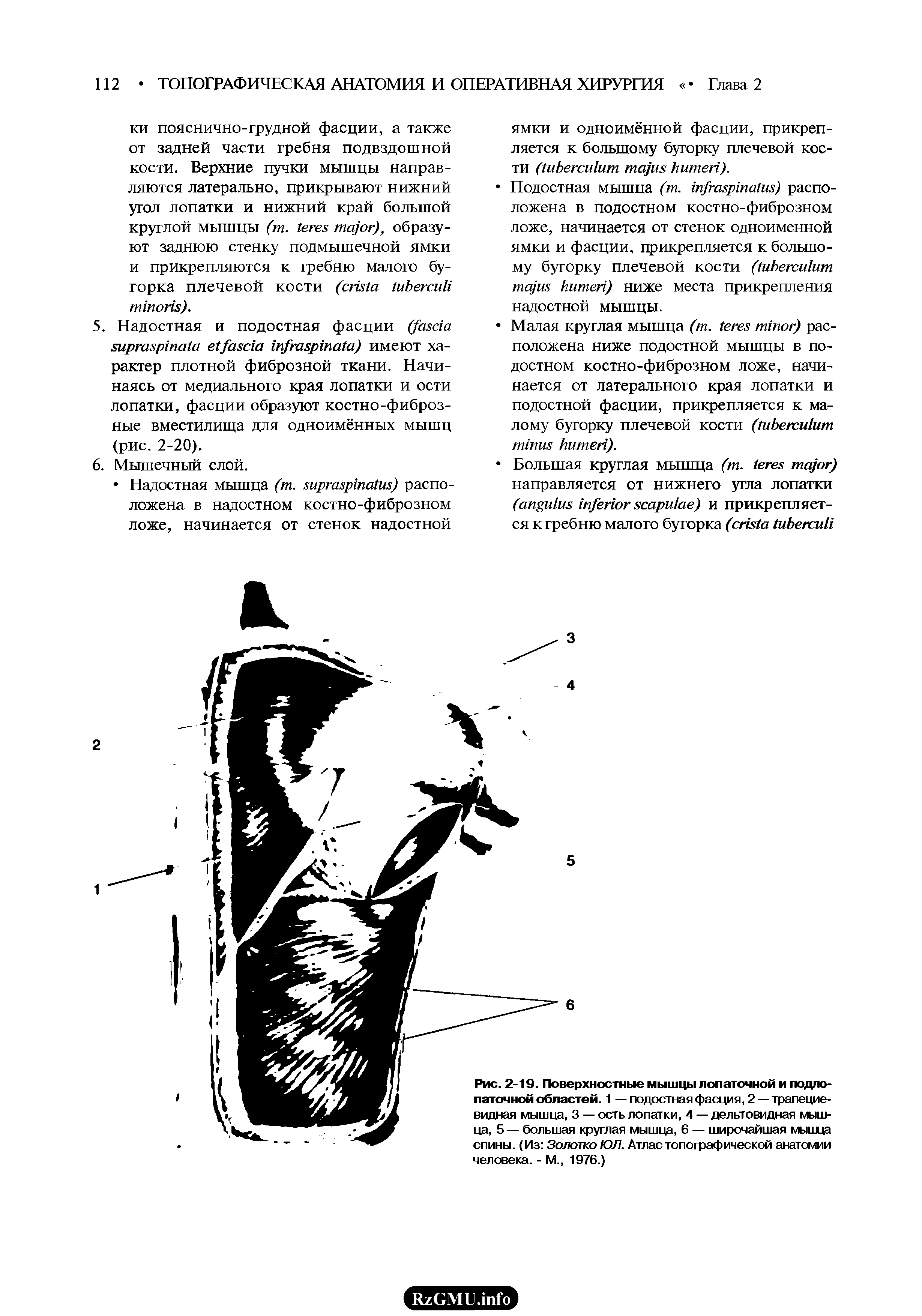 Рис. 2-19. Поверхностные мышцы лопаточной и подлопаточной областей. 1 — подостная фасция, 2—трапециевидная мышца, 3 — ость лопатки, 4 — дельтовидная мышца, 5 — большая круглая мышца, 6 — широчайшая мышца спины. (Из Золотко ЮЛ. Атлас топографической анатомии человека. - М., 1976.)...