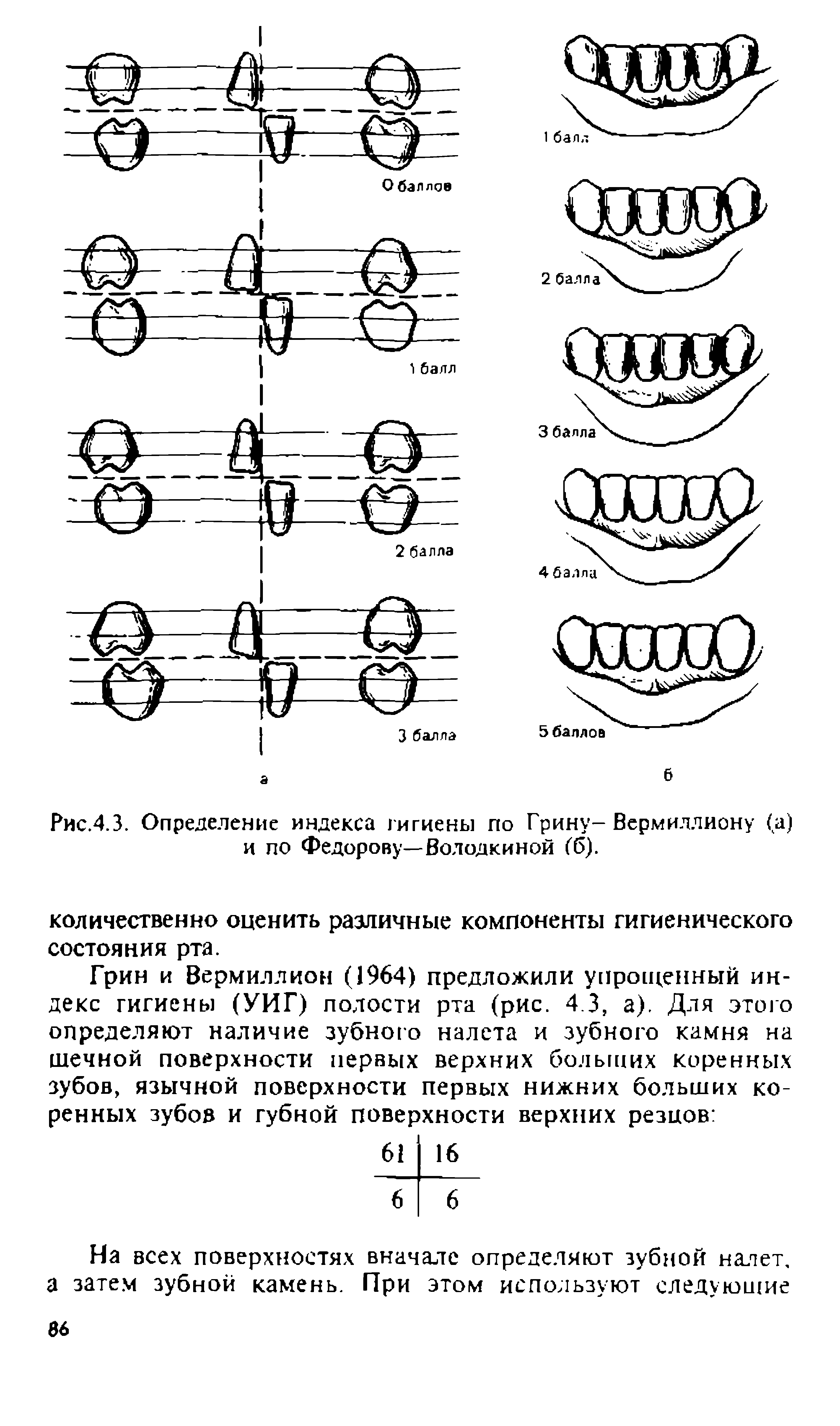 Индекс грина. Гигиенический индекс по Грину Вермильону. Упрощенный индекс гигиены полости рта Грина-Вермиллиона. Индекс гигиены по Грину Вермиллиону. Индекс Грина Вермильона в стоматологии.