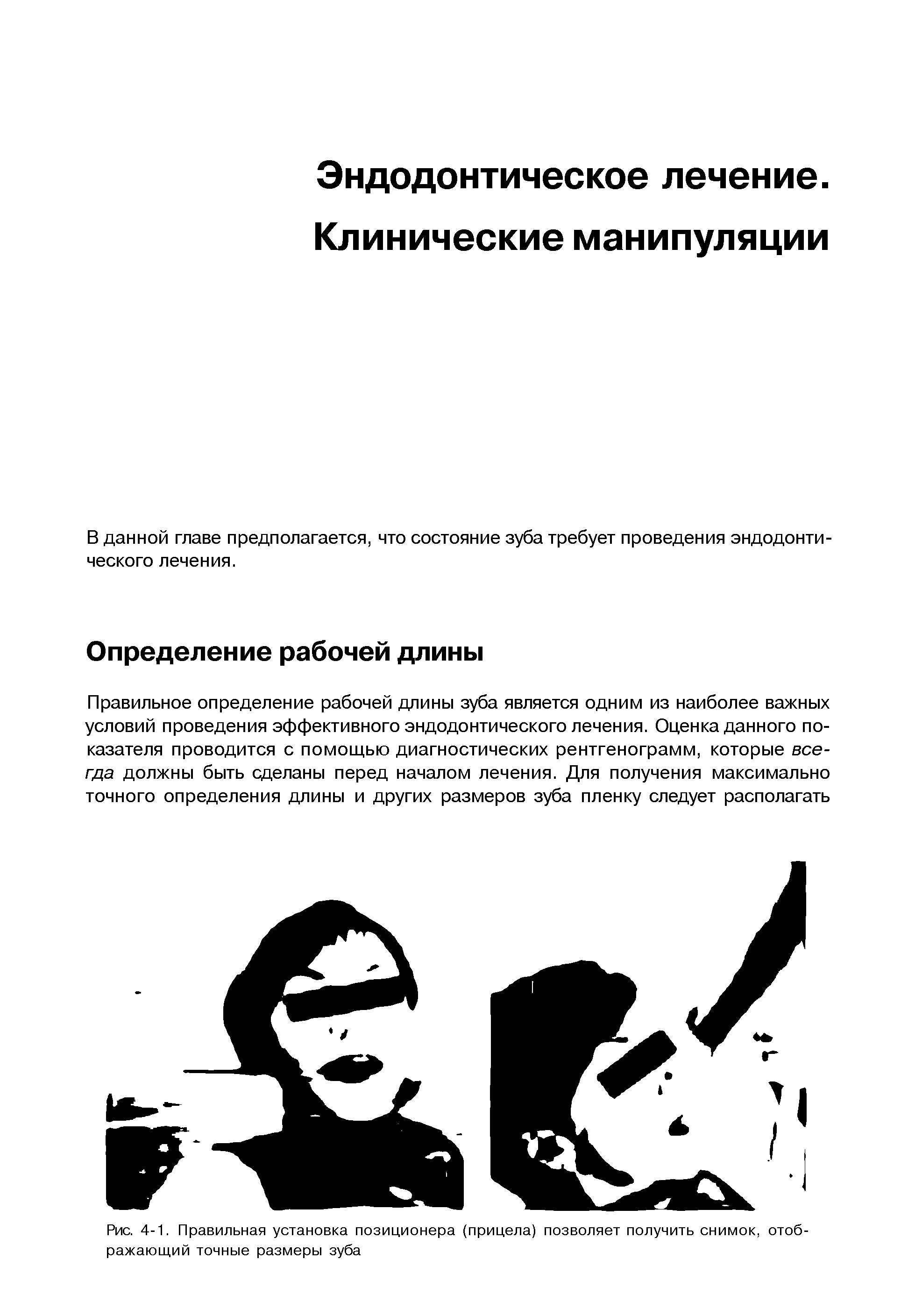 Рис. 4-1. Правильная установка позиционера (прицела) позволяет получить снимок, отображающий точные размеры зуба...