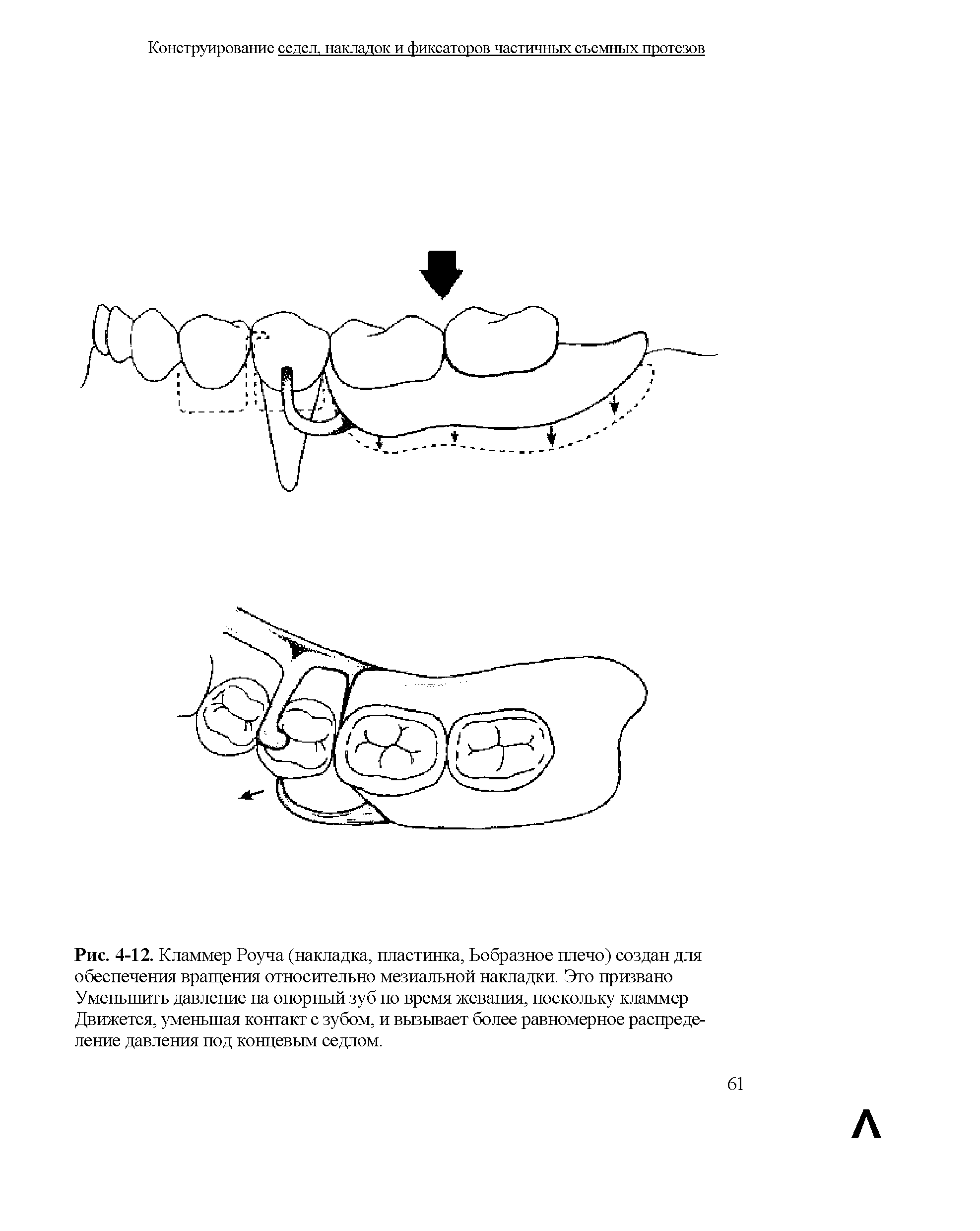 Рис. 4-12. Кламмер Роуча (накладка, пластинка, Ьобразное плечо) создан для обеспечения вращения относительно мезиальной накладки. Эго призвано Уменьшить давление на опорный зуб по время жевания, поскольку кламмер Движется, уменьшая контакт с зубом, и вызывает более равномерное распределение давления под концевым седлом.