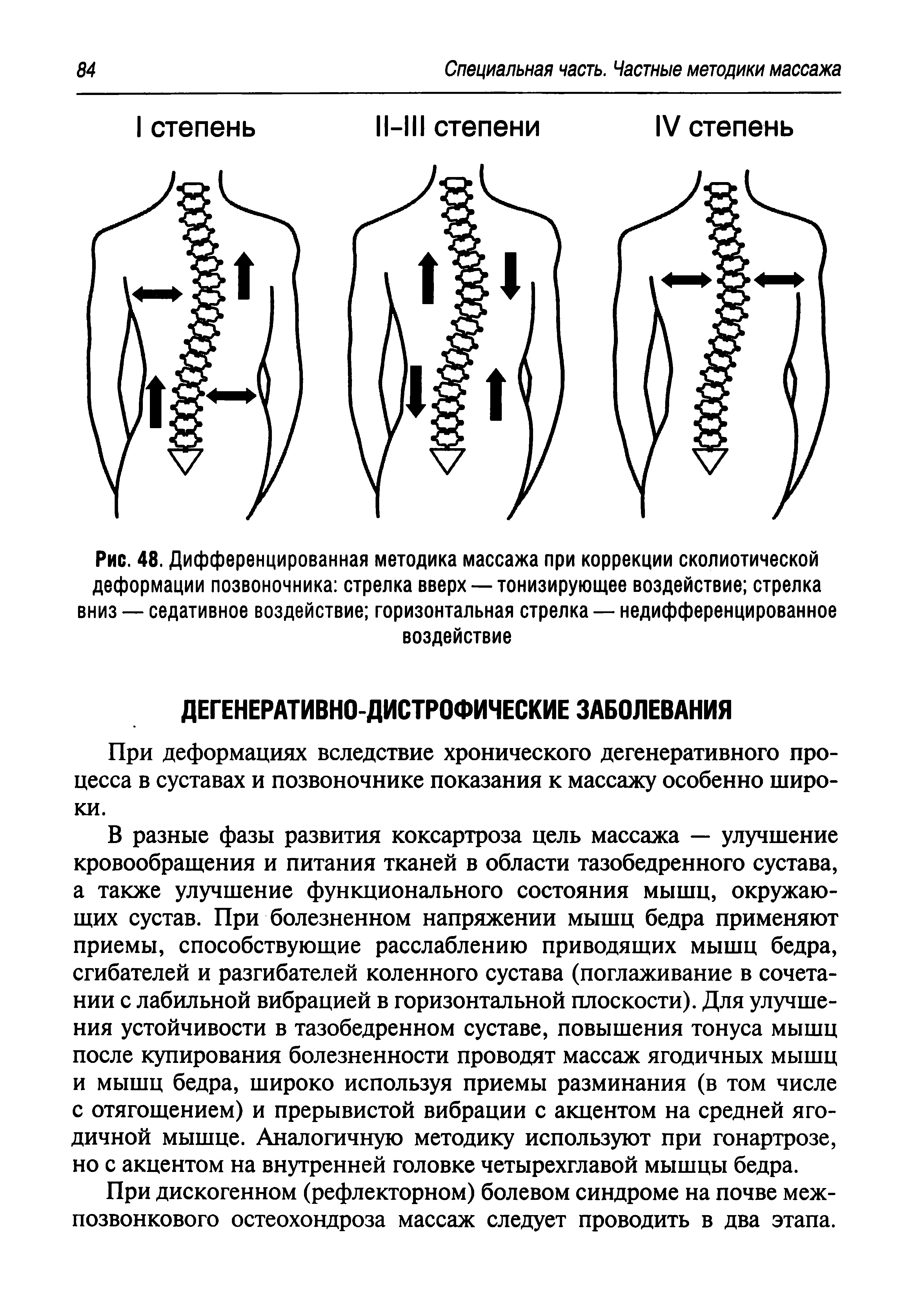 Рис. 48. Дифференцированная методика массажа при коррекции сколиотической деформации позвоночника стрелка вверх — тонизирующее воздействие стрелка вниз — седативное воздействие горизонтальная стрелка — недифференцированное воздействие...