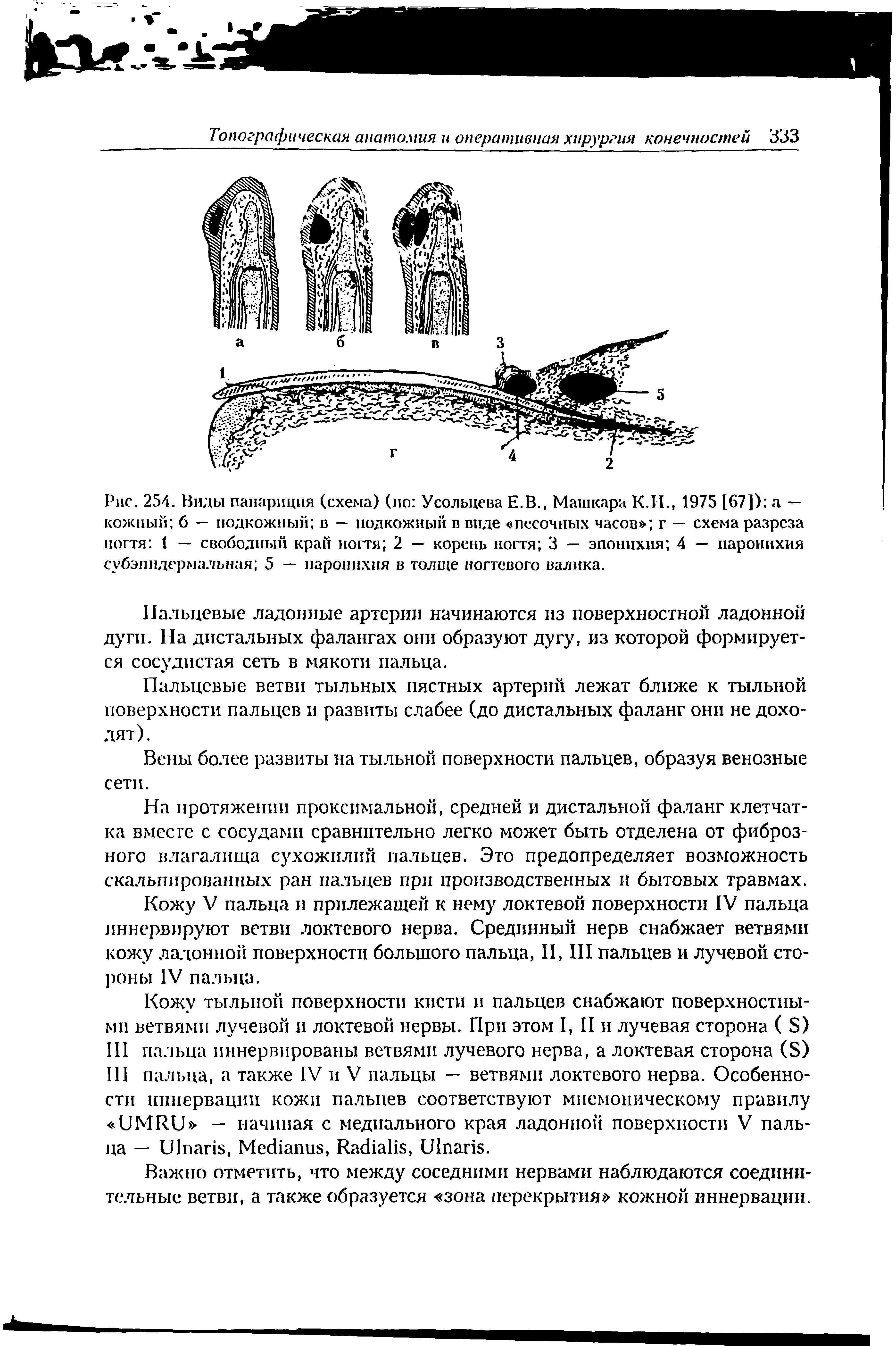 Рис. 254. Виды панариция (схема) (по Усольцева Е.В., Машкара К.И., 1975 [67]) а — кожный б — подкожный в — подкожный в виде песочных часов г — схема разреза ногтя 1 — свободный край ногтя 2 — корень ногтя 3 — эпоннхия 4 — паронихия субэпидермальная 5 — паронихия в толще ногтевого валика.