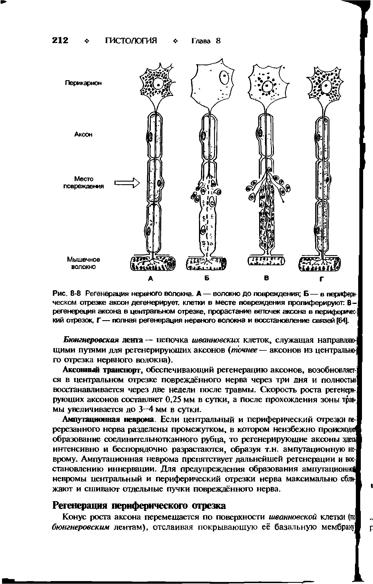 Рис. 8-8 Регенерация нервного волокна. А — волокно до повреждения Б— в периферическом отрезке аксон дегенерирует, клетки в месте повреждения пролиферируют В-регенереция аксона в центральном отрезке, прорастание веточек аксона в периферический отрезок, Г — полная регенерация нервного волокна и восстановление связей [64].