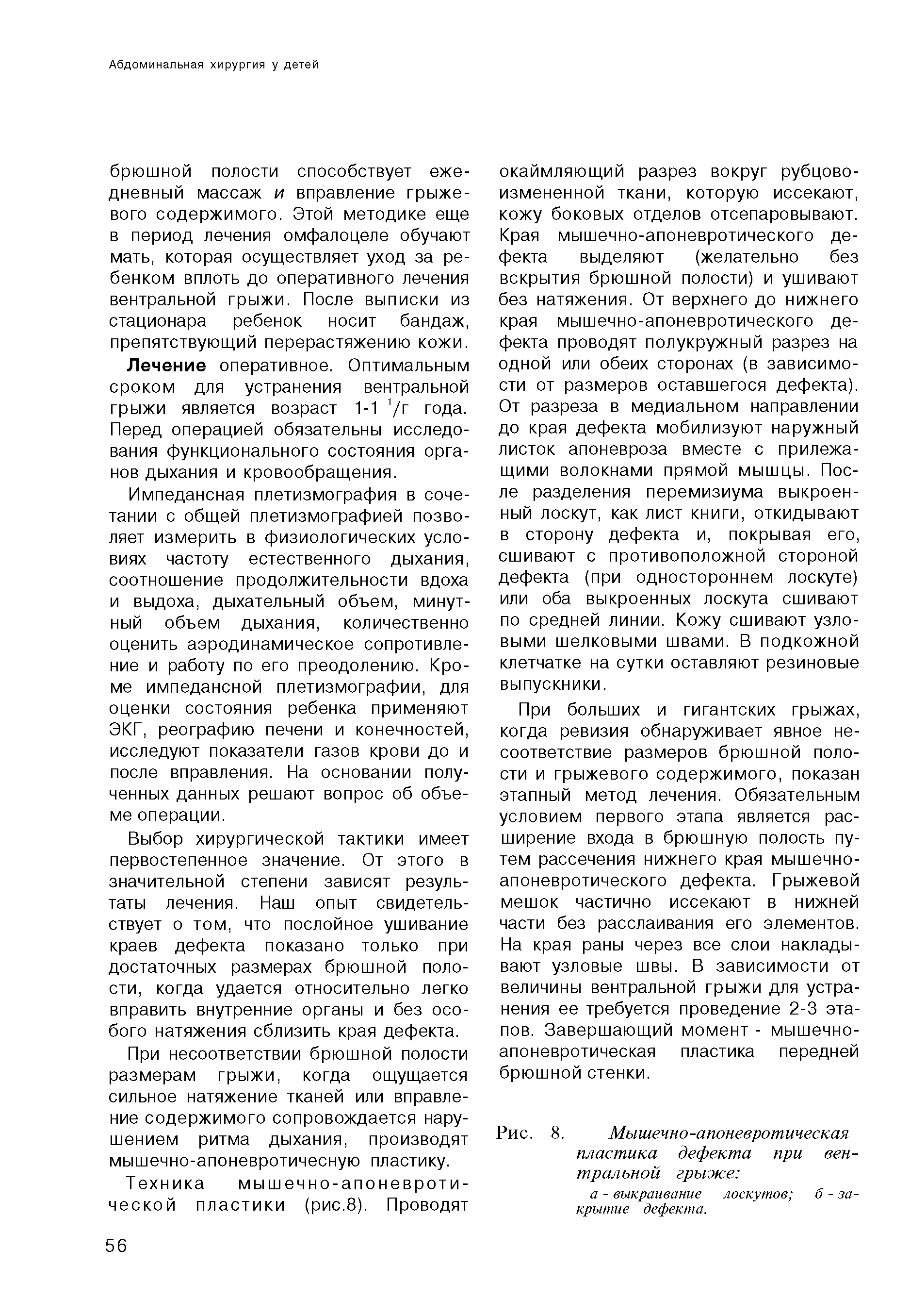 Рис. 8. Мышечно-апоневротическая пластика дефекта при вентральной грыже ...