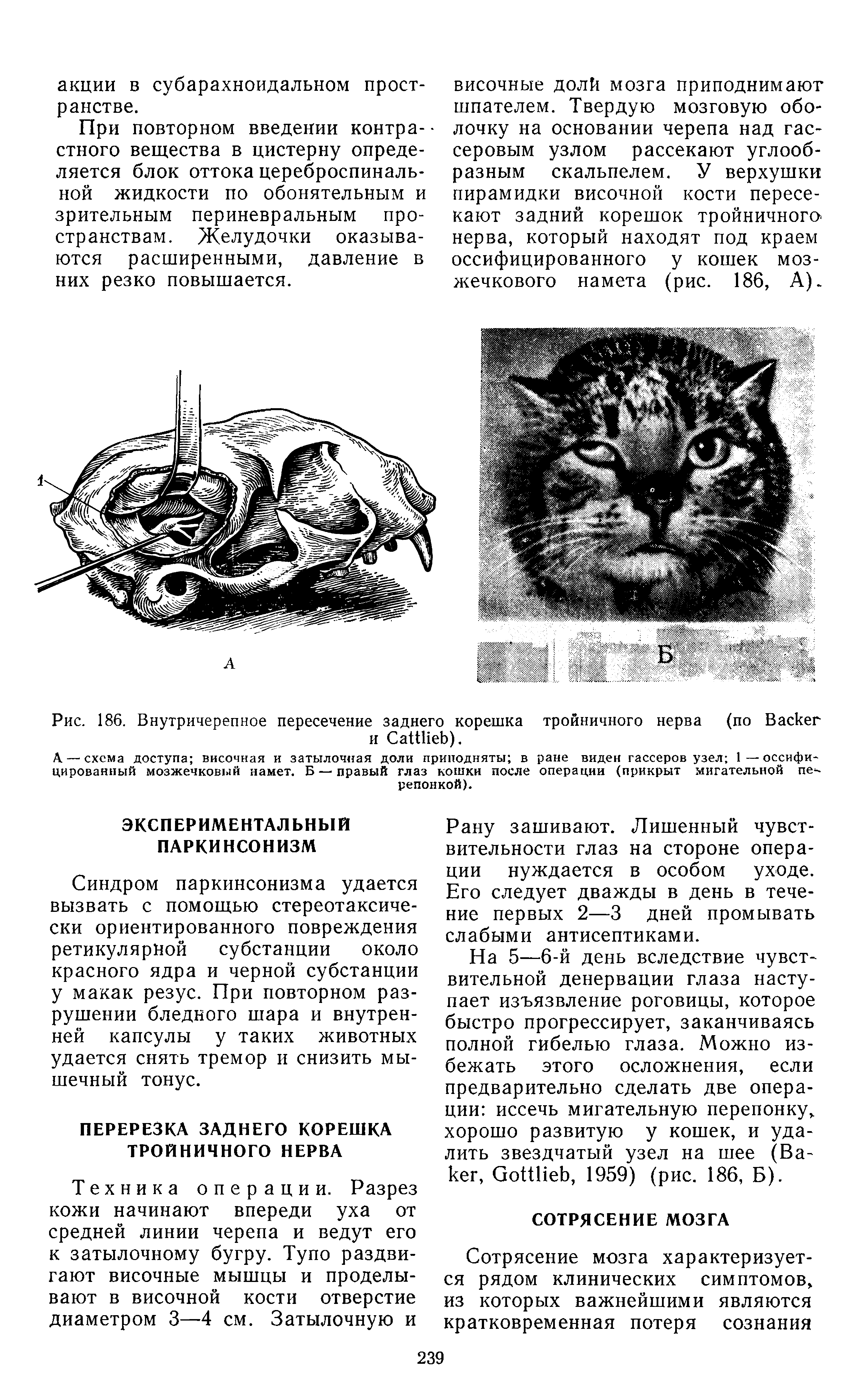 Рис. 186. Внутричерепное пересечение заднего корешка тройничного нерва (по B и C ).