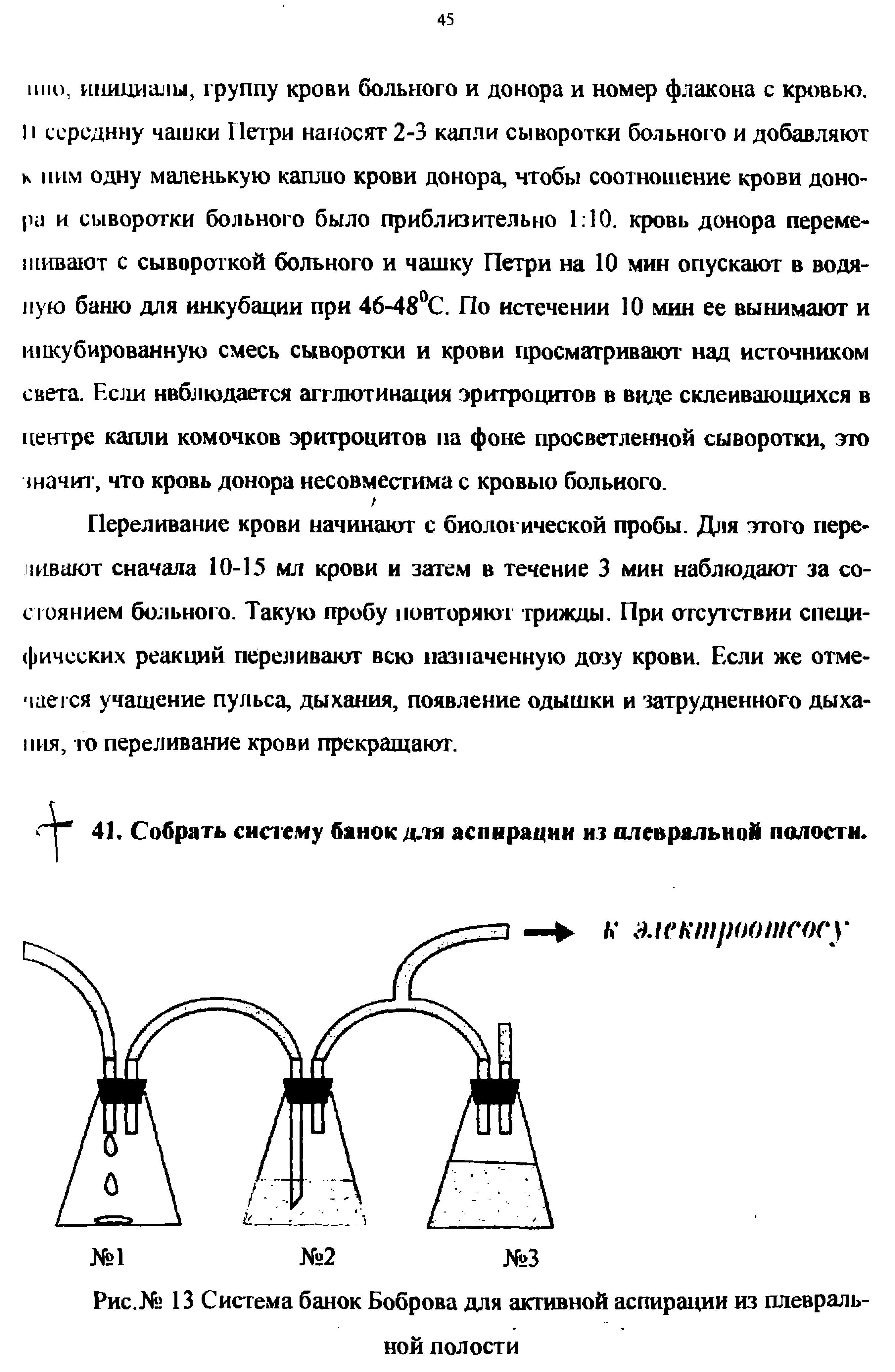 Рис.№ 13 Система банок Боброва для активной аспирации из плевраль-...