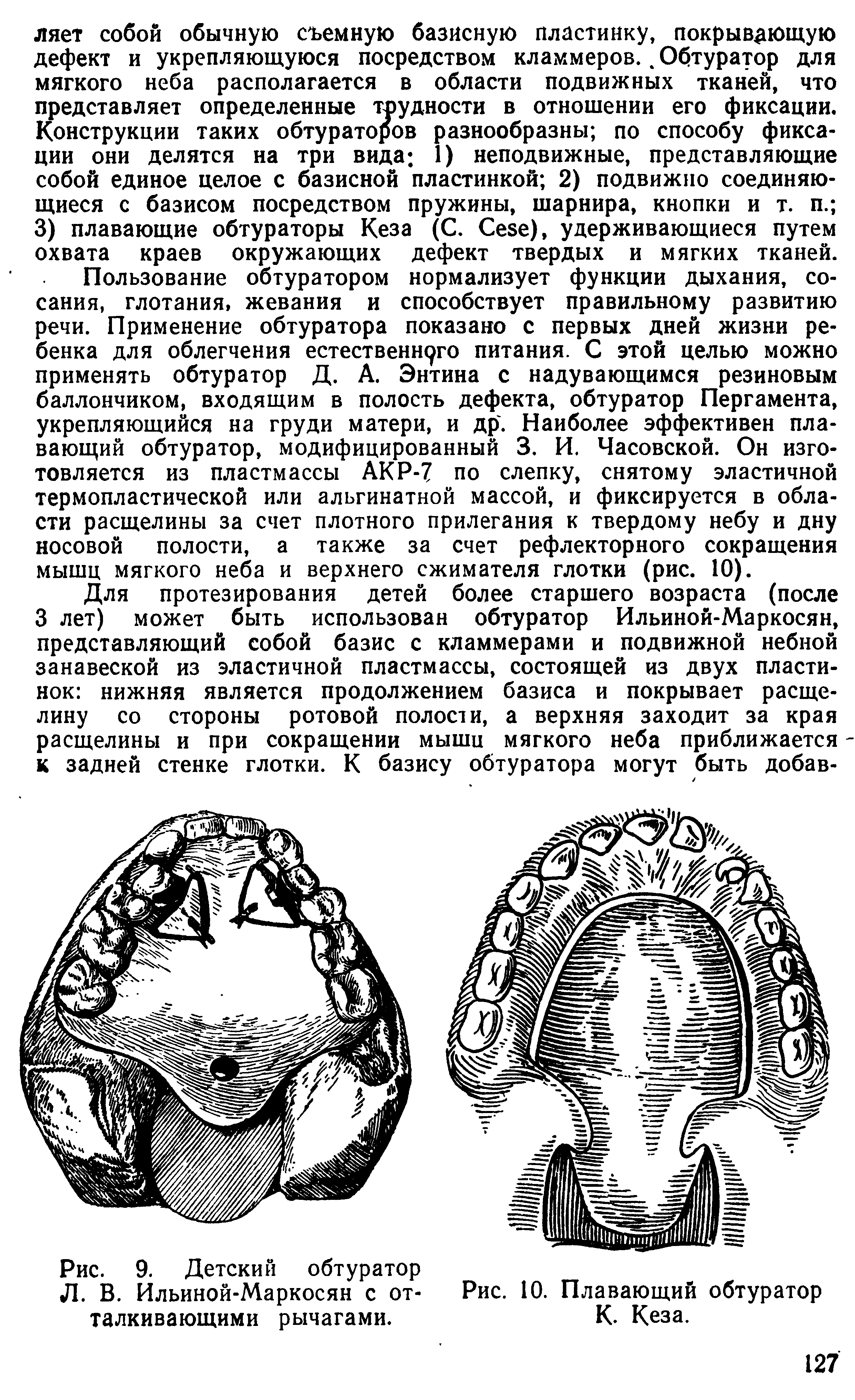 Рис. 9. Детский обтуратор Л. В. Ильиной-Маркосян с отталкивающими рычагами.