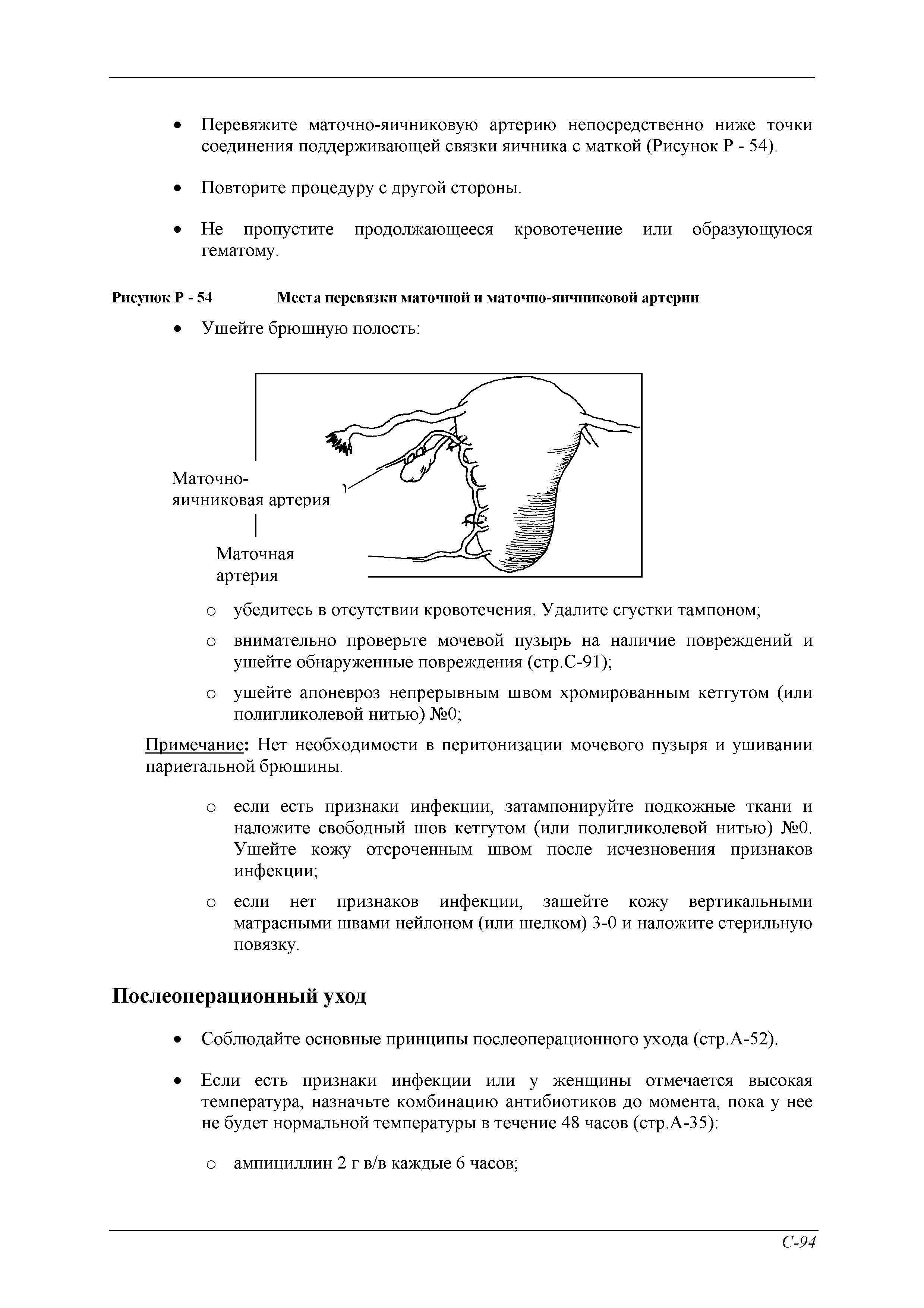 Рисунок Р - 54 Места перевязки маточной и маточно-яичниковой артерии...