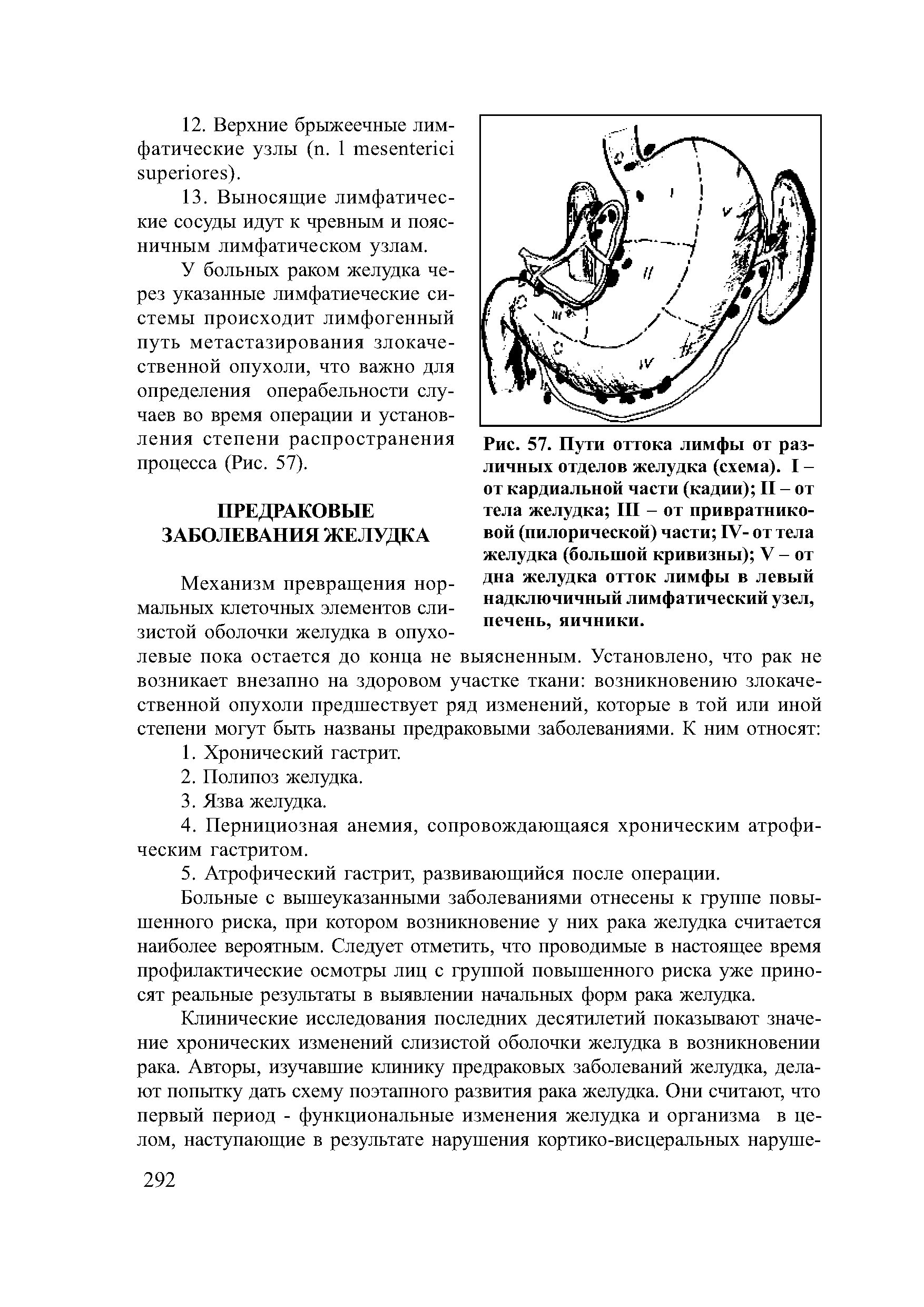 Рис. 57. Пути оттока лимфы от различных отделов желудка (схема). I -от кардиальной части (кадии) II - от тела желудка III - от привратниковой (пилорической) части IV- от тела желудка (большой кривизны) V - от дна желудка отток лимфы в левый надключичный лимфатический узел, печень, яичники.