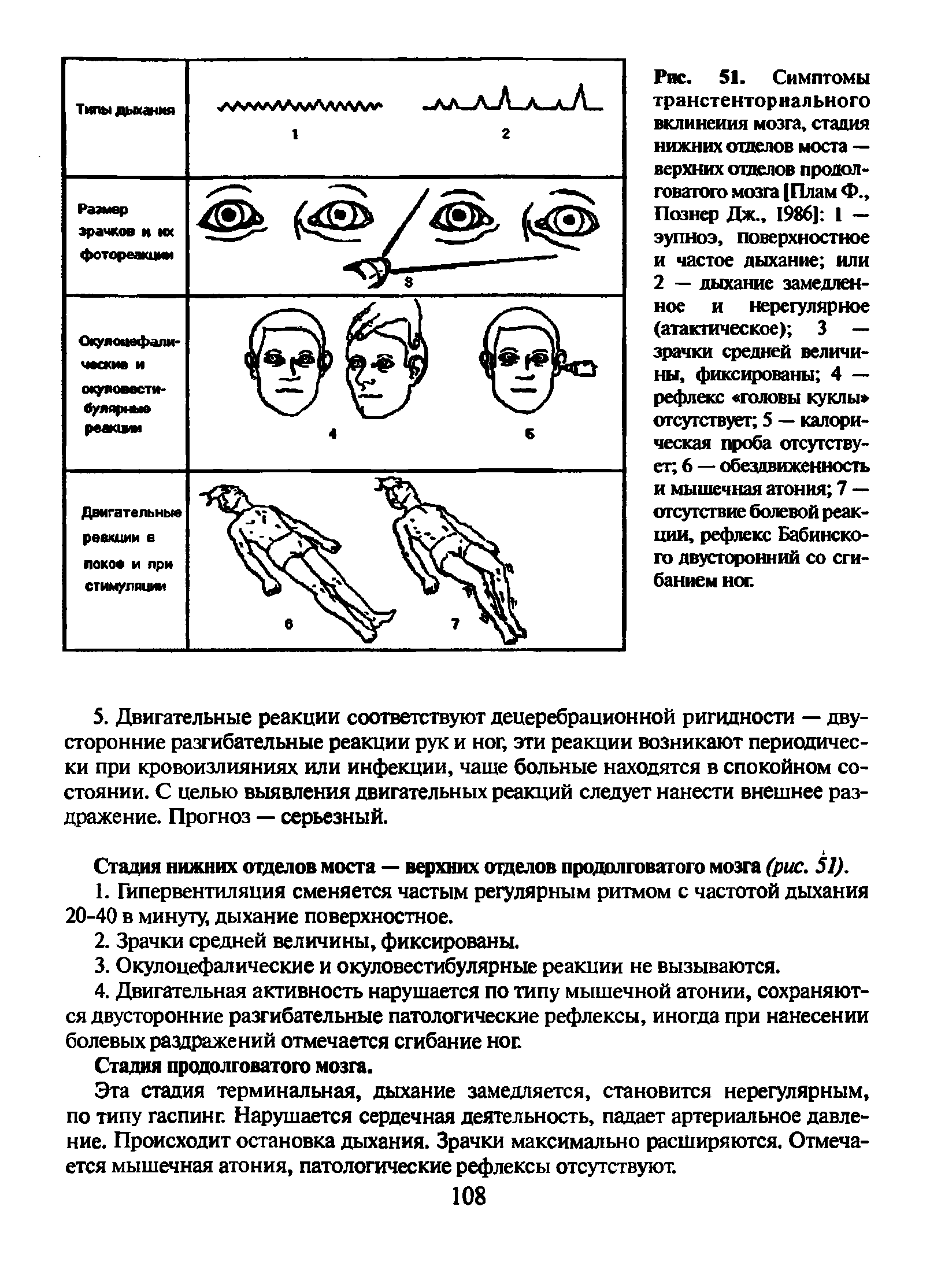 Рис. 51. Симптомы транстенториального вклинения мозга, стация нижних отделов моста — верхних отделов продолговатого мозга [Плам Ф., Познер Дж., 1986] I — эупноэ, поверхностное и частое дыхание или 2 — дыхание замедленное и нерегулярное (атактическое) 3 —...