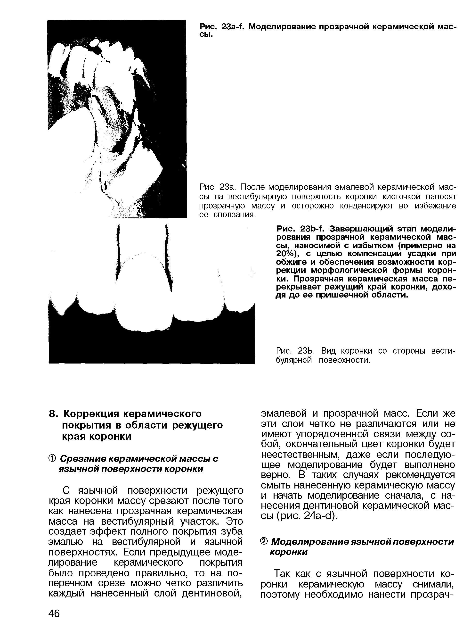 Рис. 23а. После моделирования эмалевой керамической массы на вестибулярную поверхность коронки кисточкой наносят прозрачную массу и осторожно конденсируют во избежание ее сползания.