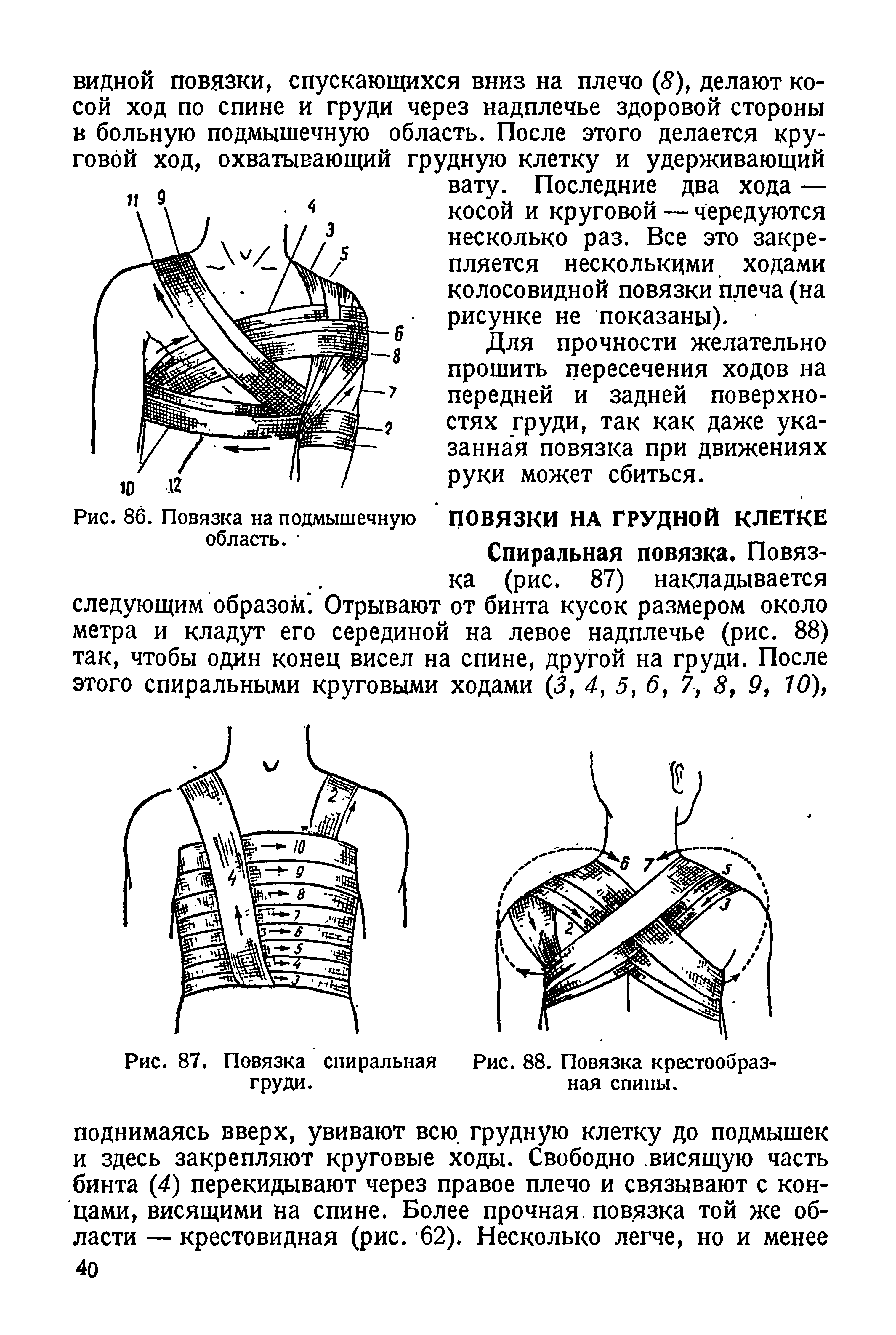 Рис. 86. Повязка на подмышечную ПОВЯЗКИ НА ГРУДНОЙ КЛЕТКЕ область. Спиральная повязка. Повяз-...