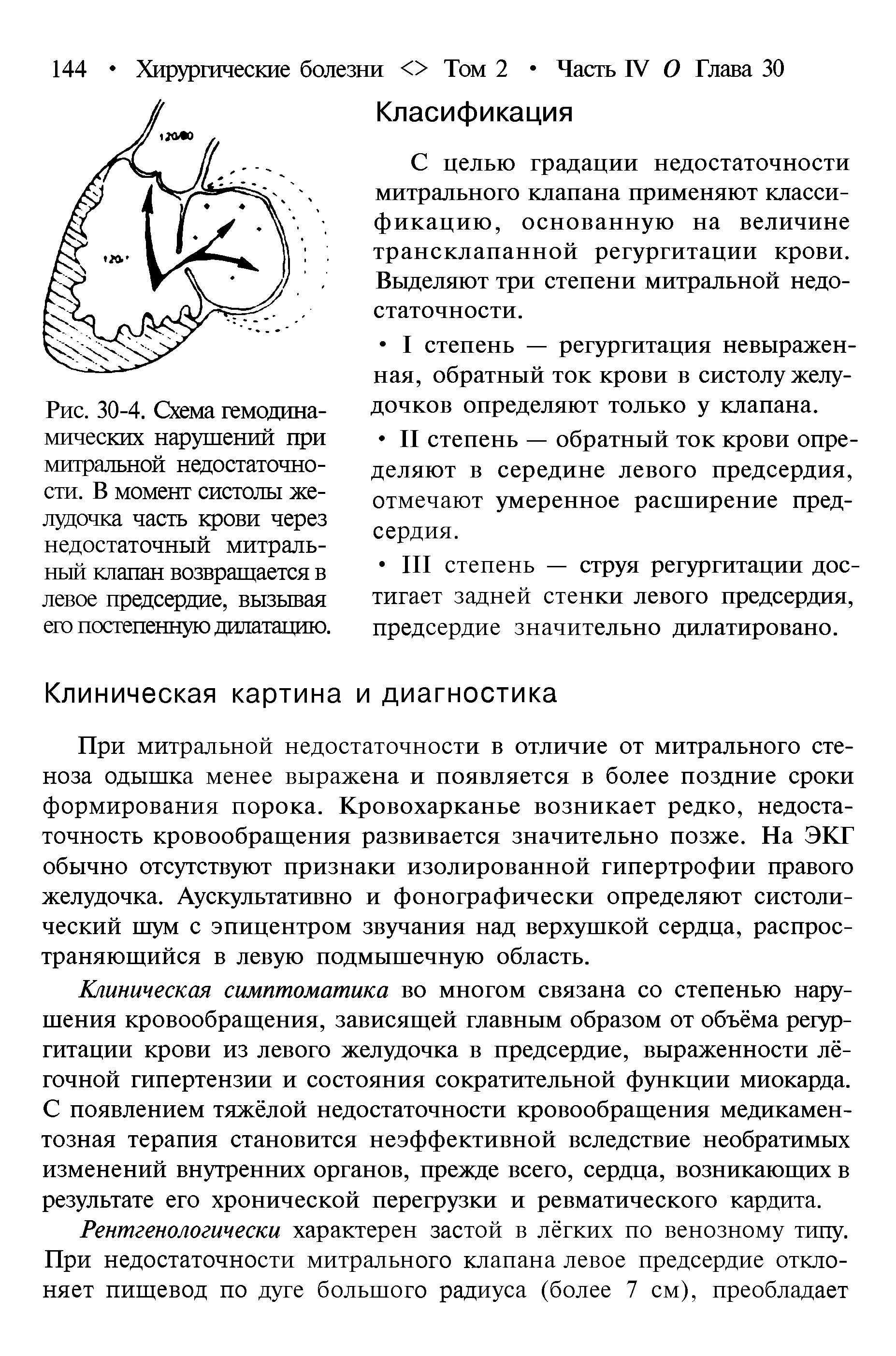 Рис. 30-4. Схема гемодинамических нарушений при митральной недостаточности. В момент систолы желудочка часть крови через недостаточный митральный клапан возвращается в левое предсердие, вызывая его постепенную дилатацию.