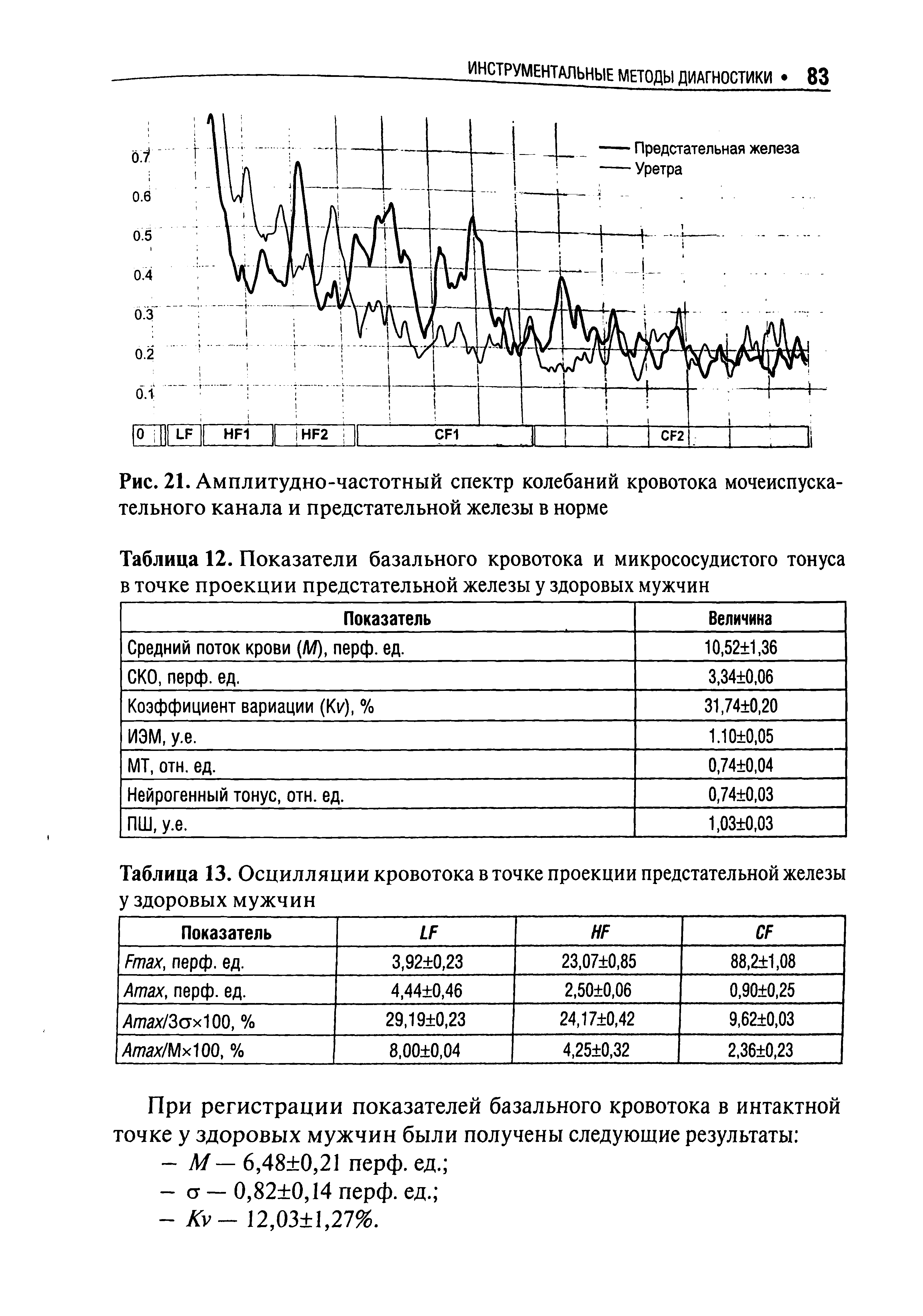 Рис. 21. Амплитудно-частотный спектр колебаний кровотока мочеиспускательного канала и предстательной железы в норме...