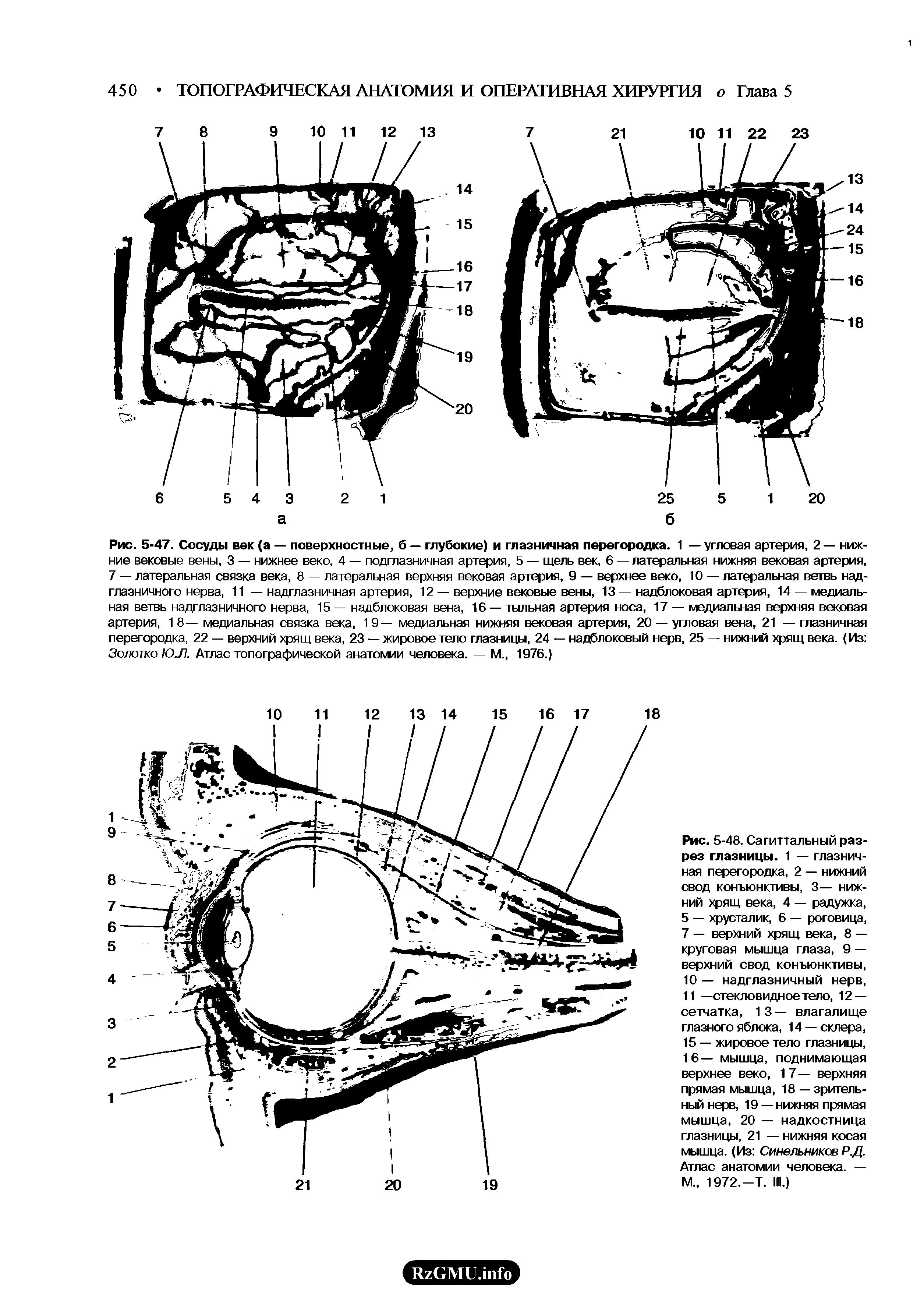 Рис. 5-48. Сагиттальный разрез глазницы. 1 — глазничная перегородка, 2 — нижний свод конъюнктивы, 3— нижний хрящ века, 4 — радужка, 5 — хрусталик, 6 — роговица, 7 — верхний хрящ века, 8 — круговая мышца глаза, 9 — верхний свод конъюнктивы,...