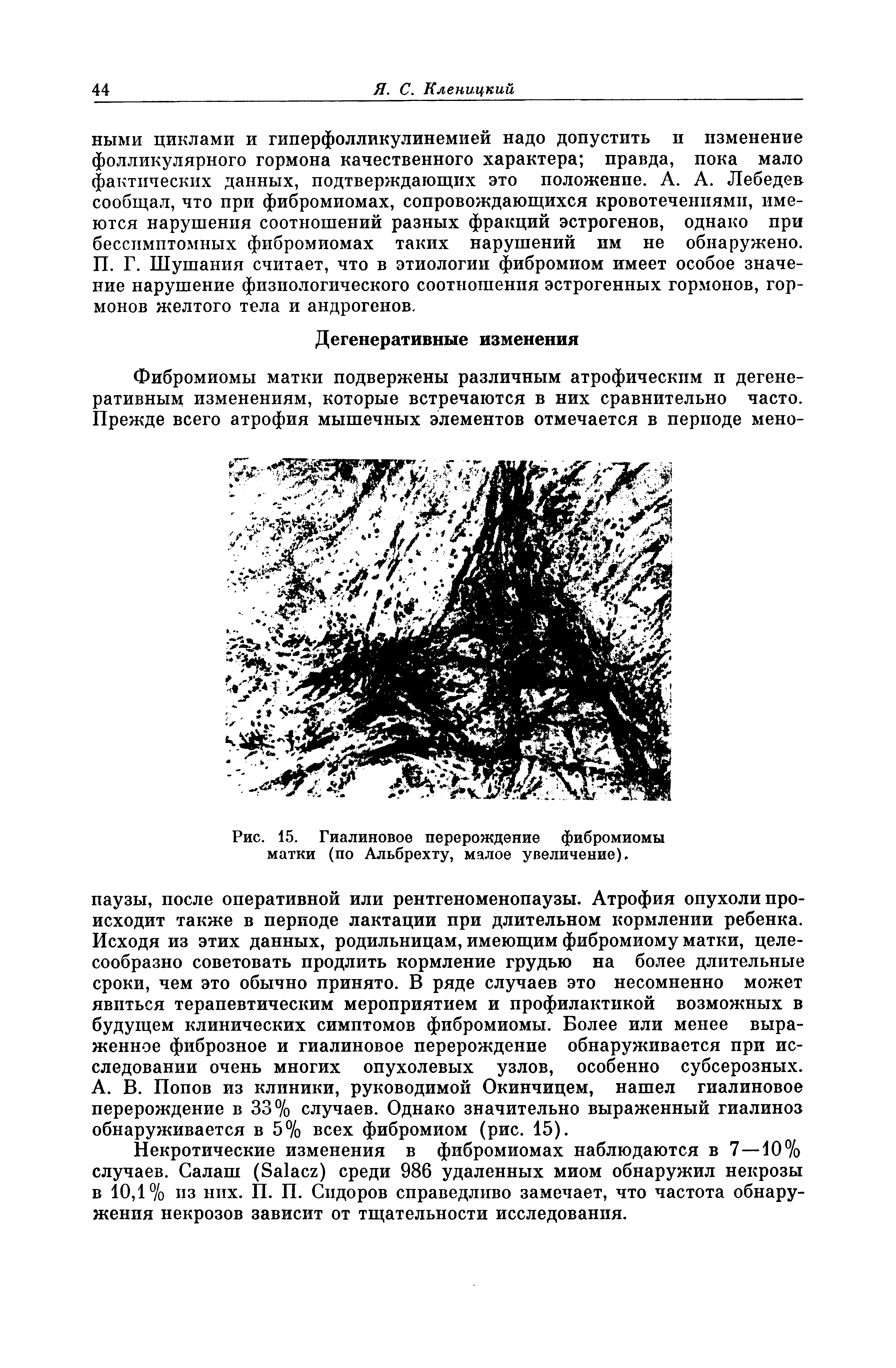 Рис. 15. Гиалиновое перерождение фибромиомы матки (по Альбрехту, малое увеличение).