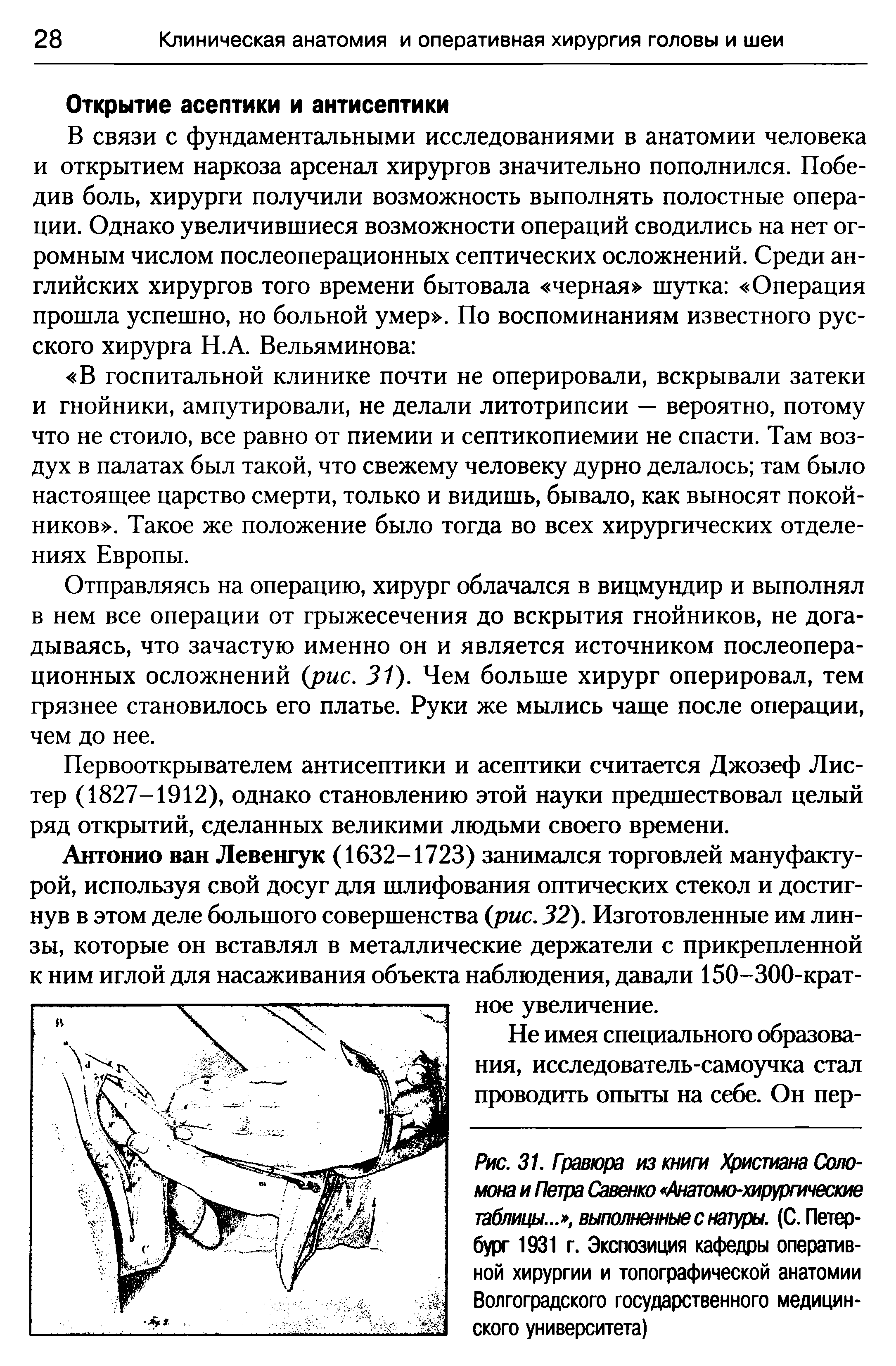 Рис. 31. Гравюра из книги Христиана Соломона и Петра Савенко Анатомо-хирургические таблицы... , выполненные с натуры. (С. Петербург 1931 г. Экспозиция кафедры оперативной хирургии и топографической анатомии Волгоградского государственного медицинского университета)...