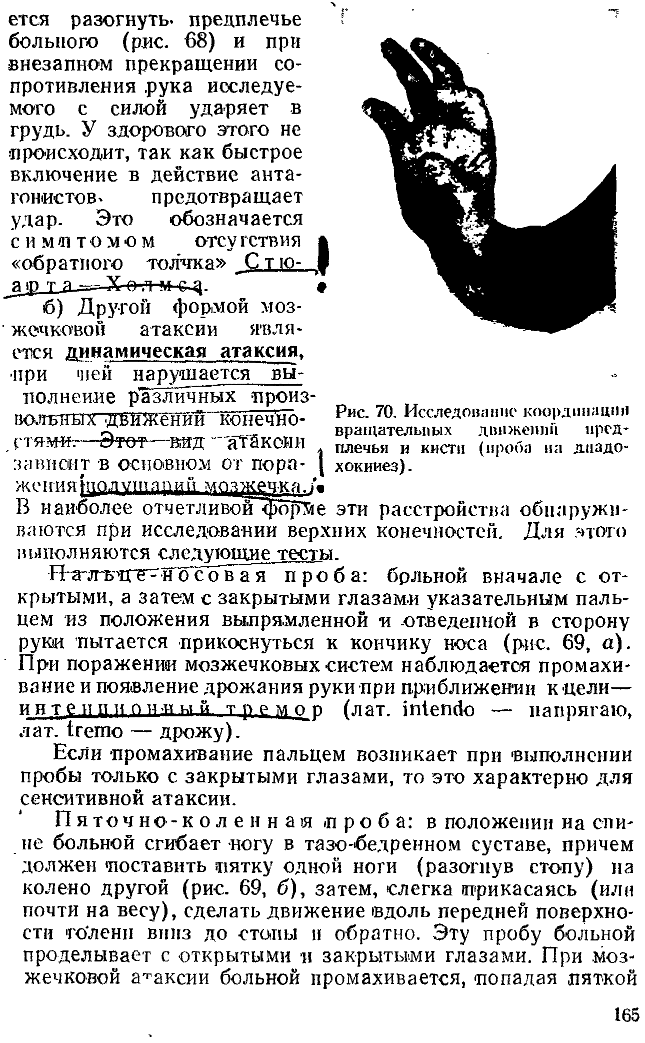 Рис. 70. Исследование координации вращательных двпжепшТ предплечья и кисти (проба на дладо-хокииез).