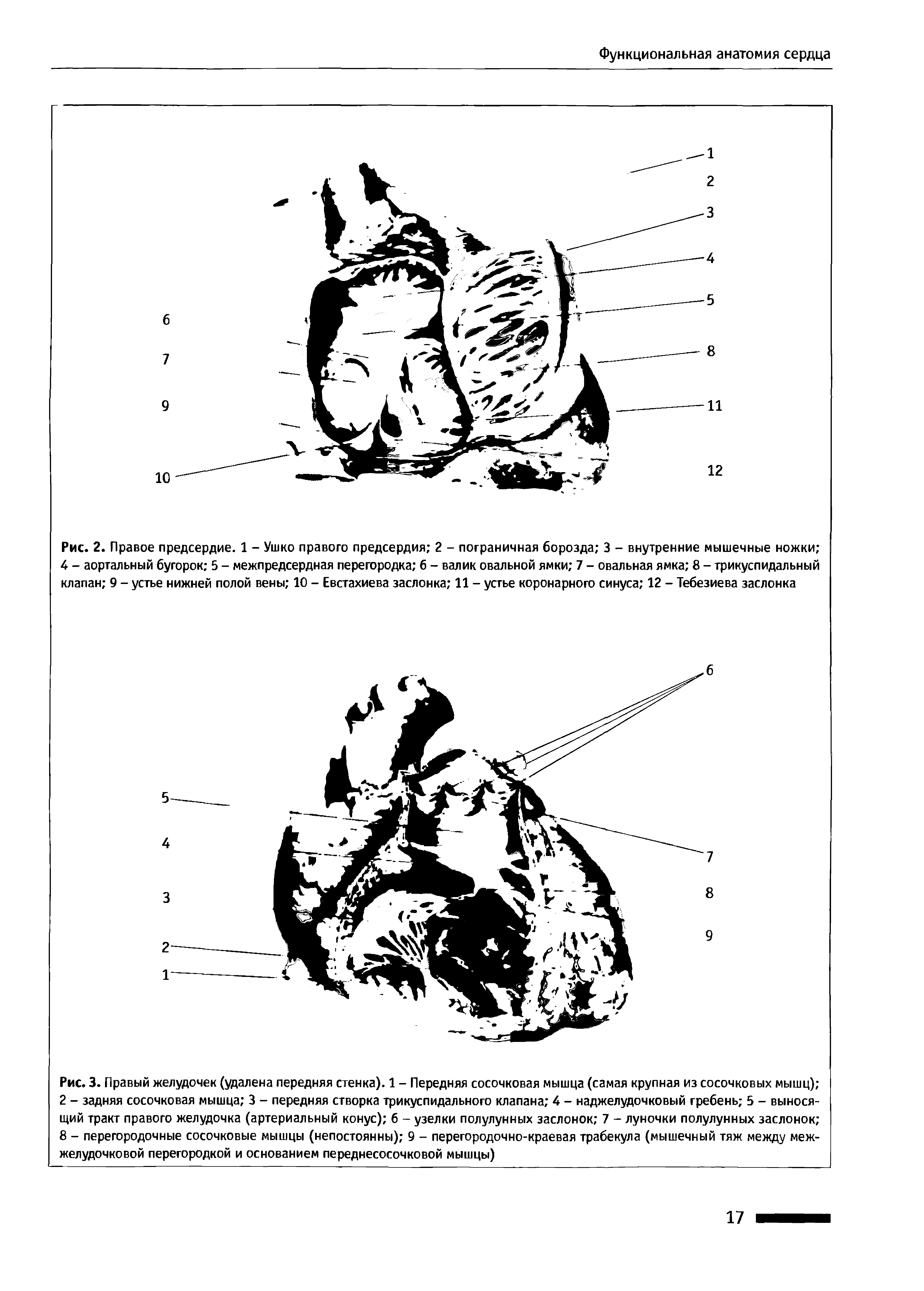 Рис. 2. Правое предсердие. 1 - Ушко правого предсердия 2 - пограничная борозда 3 - внутренние мышечные ножки 4 - аортальный бугорок 5 - межпредсердная перегородка 6 - валик овальной ямки 7 - овальная ямка 8 - трикуспидальный клапан 9 - устье нижней полой вены 10 - Евстахиева заслонка 11 - устье коронарного синуса 12 - Тебезиева заслонка...