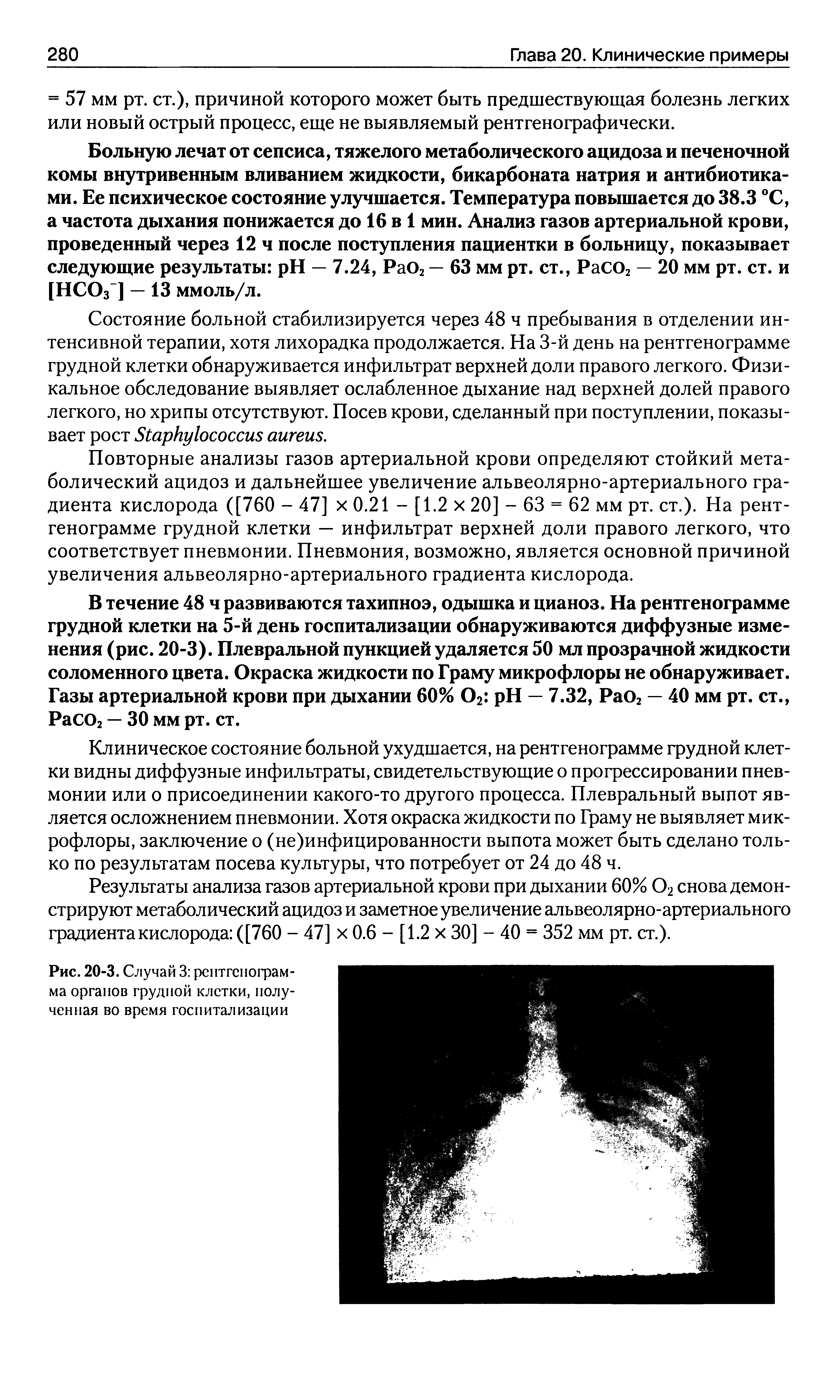 Рис. 20-3. Случай 3 рентгенограмма органов грудной клетки, полученная во время госпитализации...