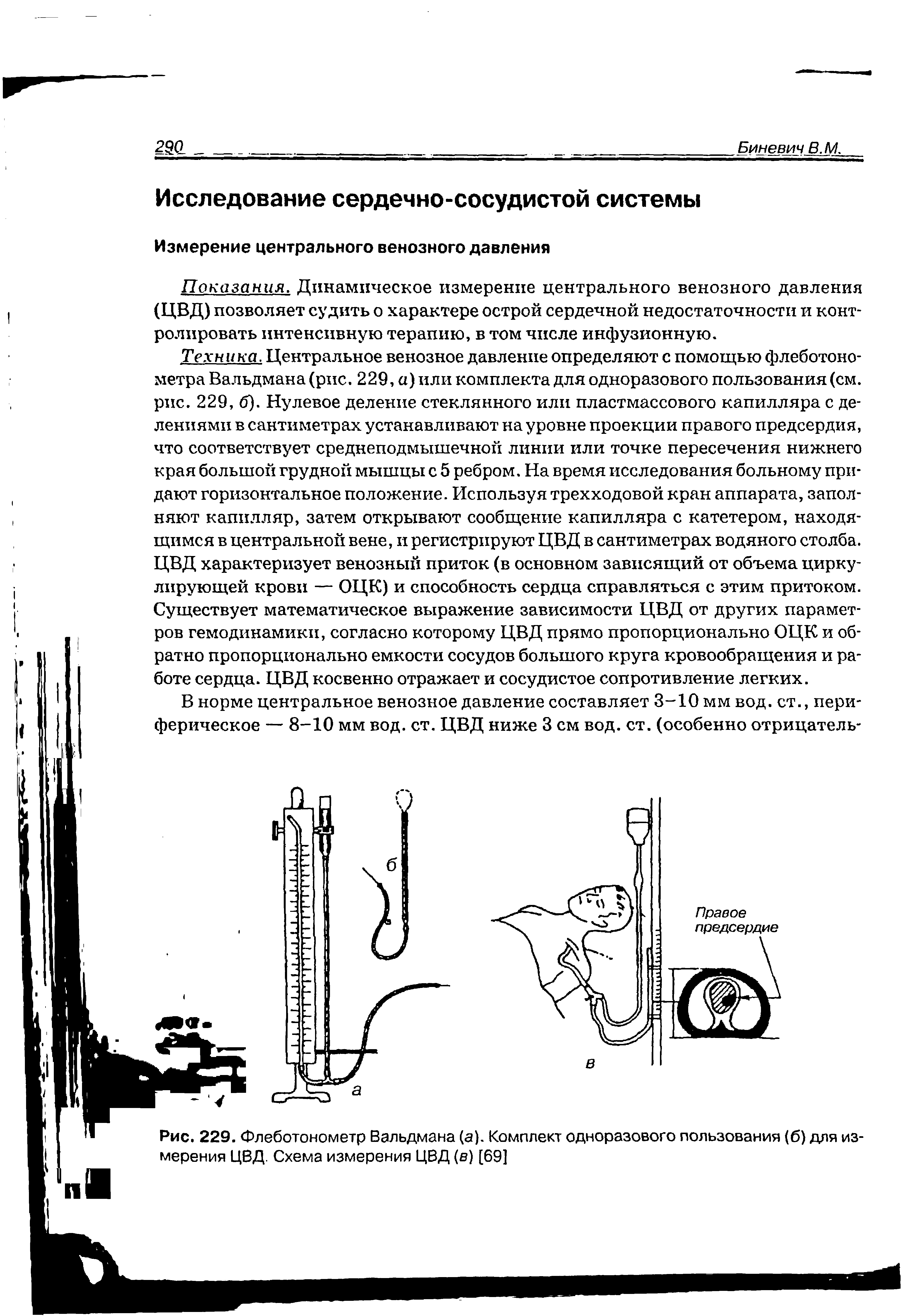 Рис. 229. Флеботонометр Вальдмана (а). Комплект одноразового пользования (б) для измерения ЦВД. Схема измерения ЦВД (в) [69]...
