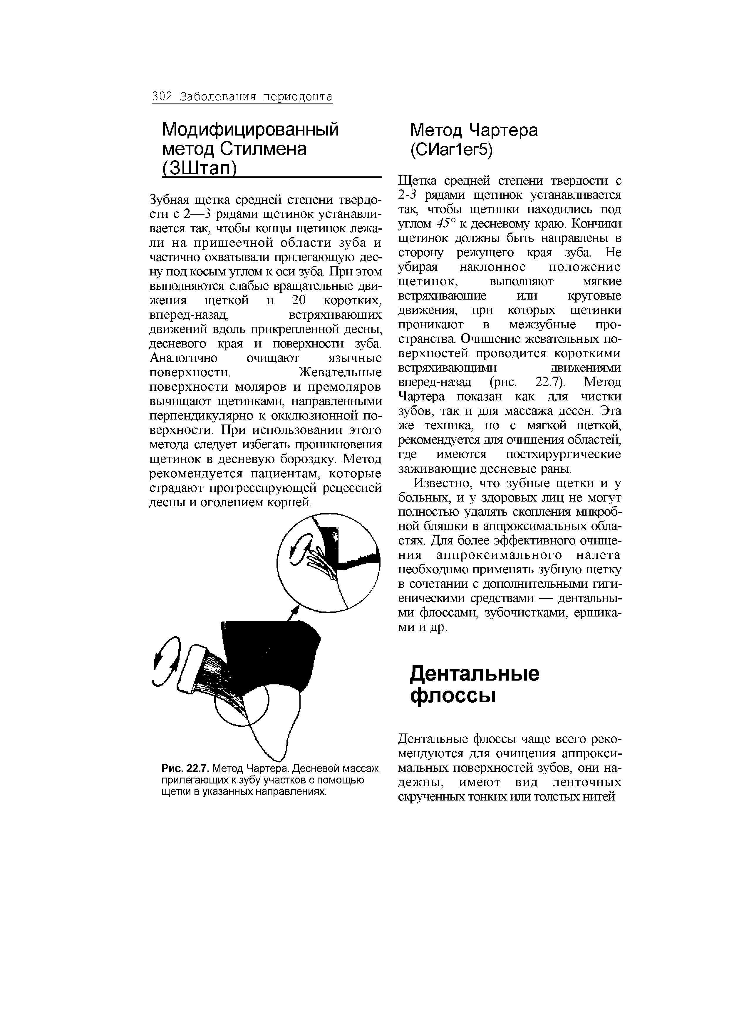 Рис. 22.7. Метод Чартера. Десневой массаж прилегающих к зубу участков с помощью щетки в указанных направлениях.