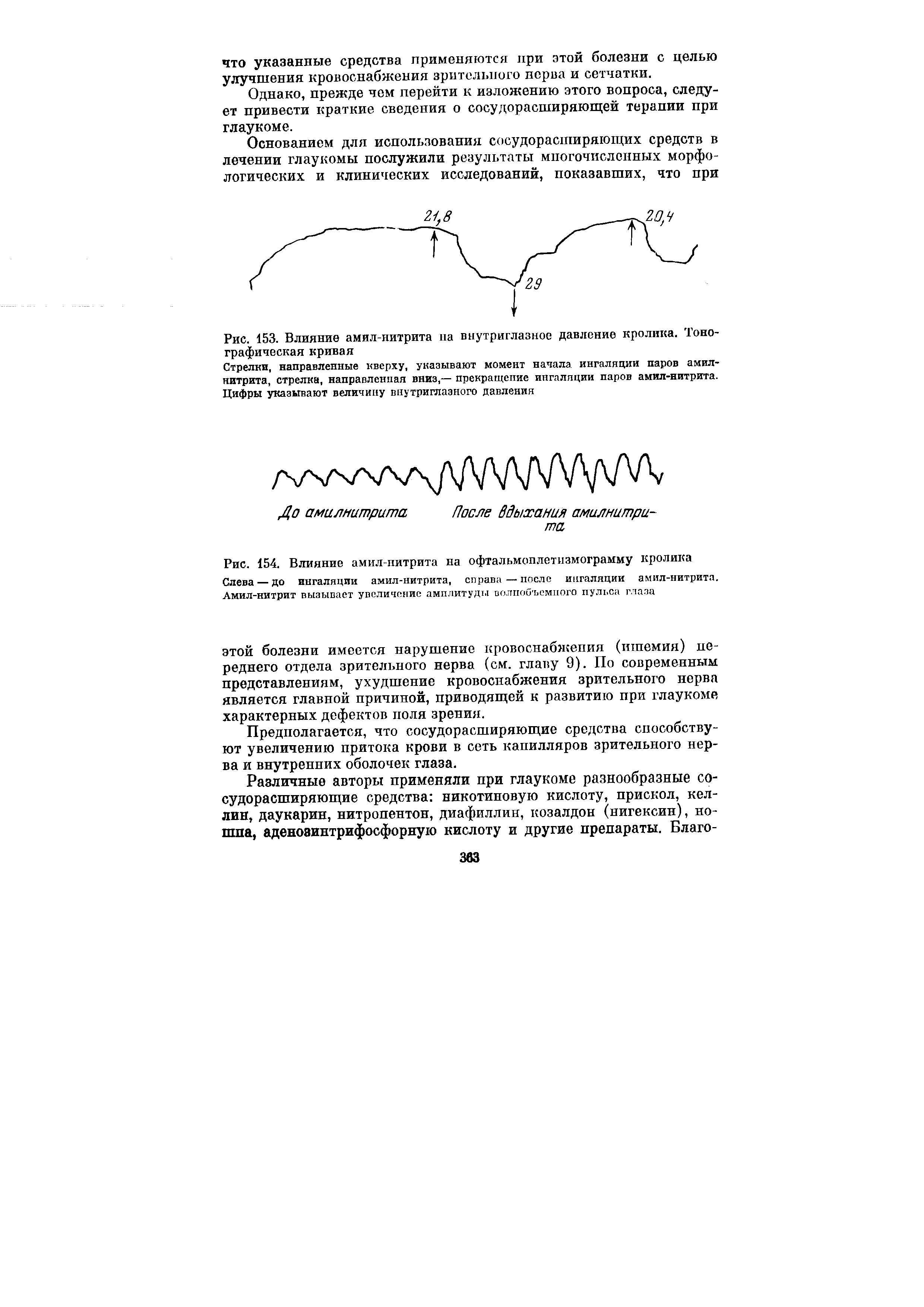 Рис. 153. Влияние амил-нитрита па внутриглазное давление кролика. Тонографическая кривая...