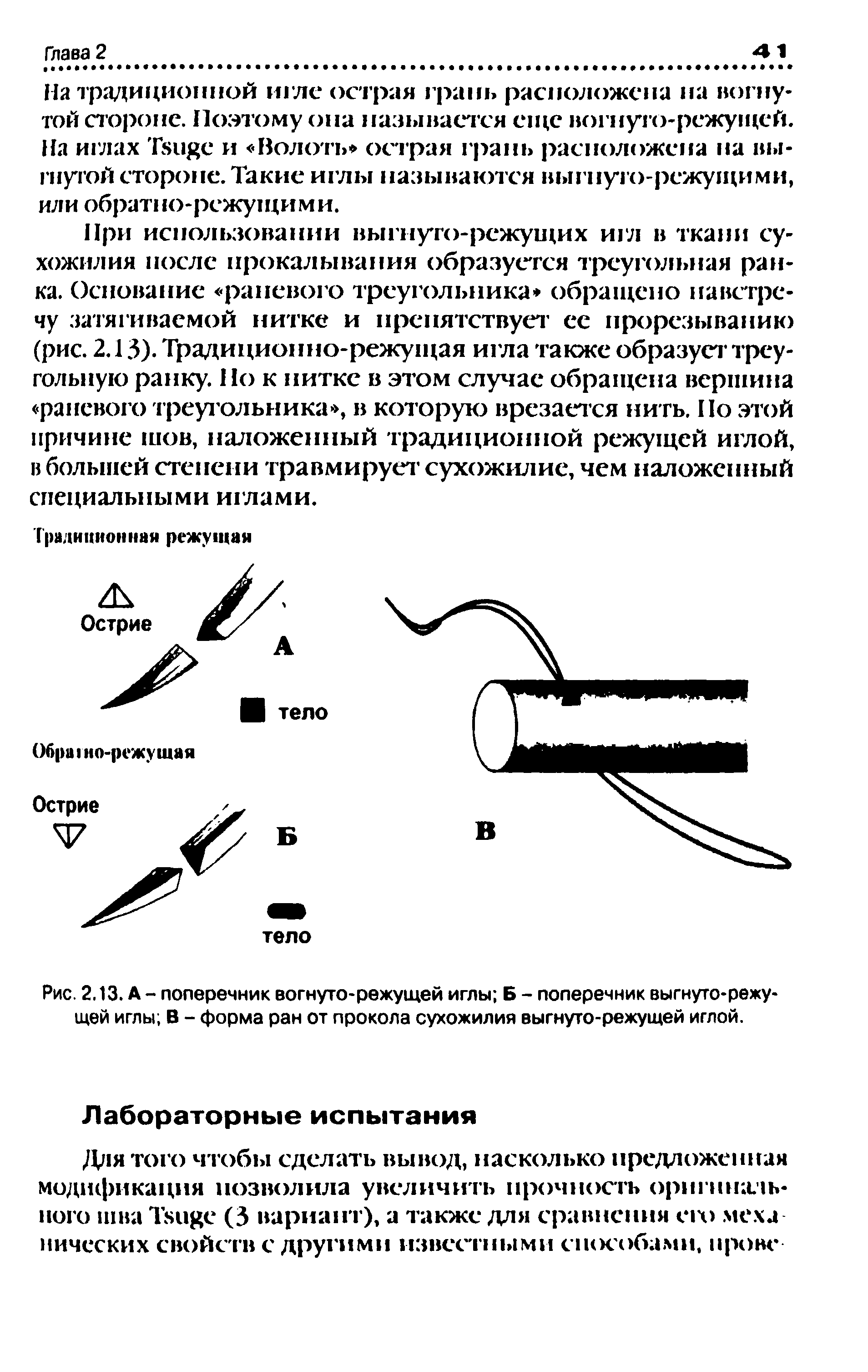 Рис. 2.13. А - поперечник вогнуто-режущей иглы Б - поперечник выгнуто-режущей иглы В - форма ран от прокола сухожилия выгнуто-режущей иглой.