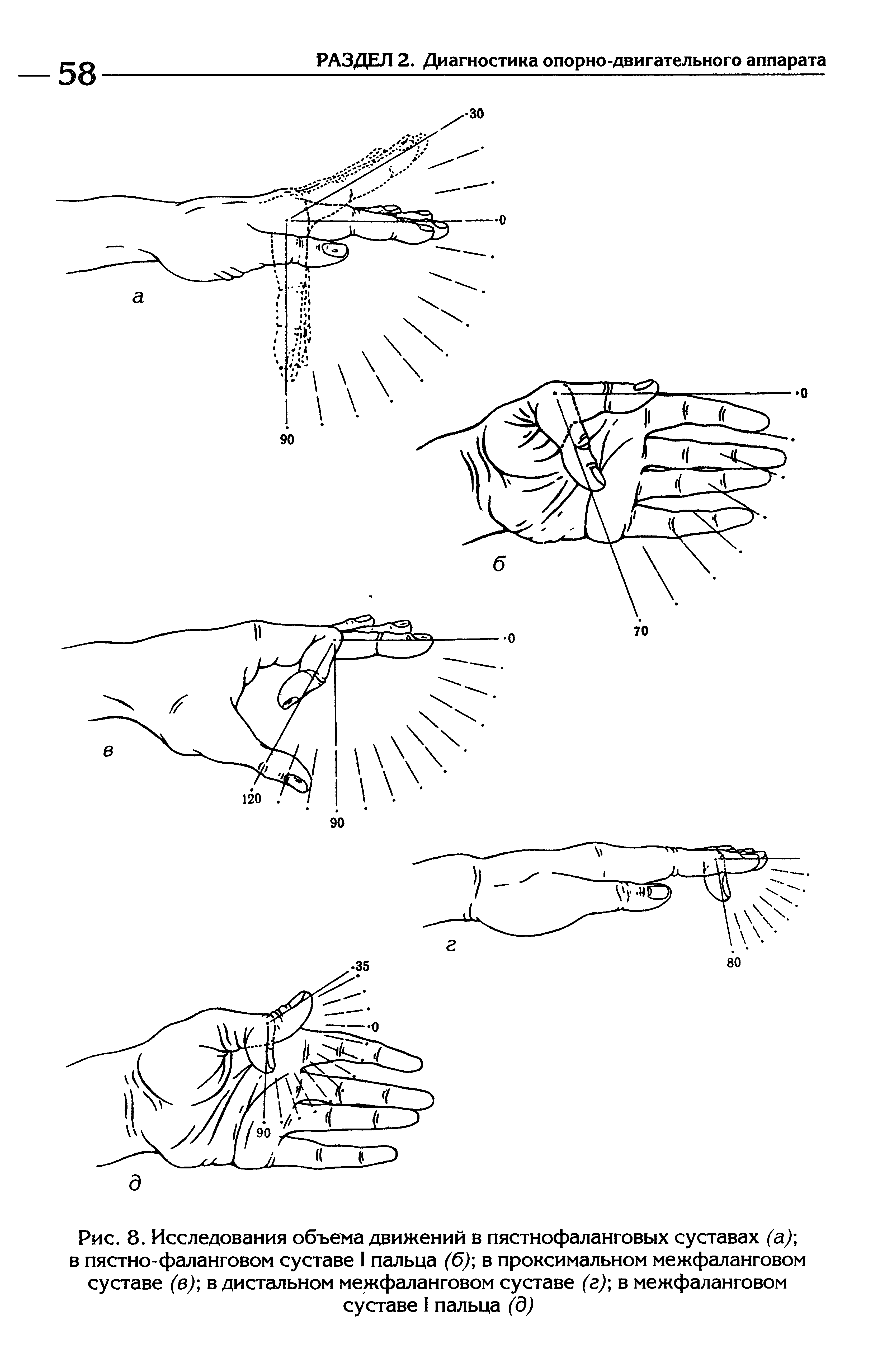 Рис. 8. Исследования объема движений в пястнофаланговых суставах (а) в пястно-фаланговом суставе I пальца (б) в проксимальном межфаланговом суставе (в)-, в дистальном межфаланговом суставе (г) в межфаланговом суставе I пальца (д)...