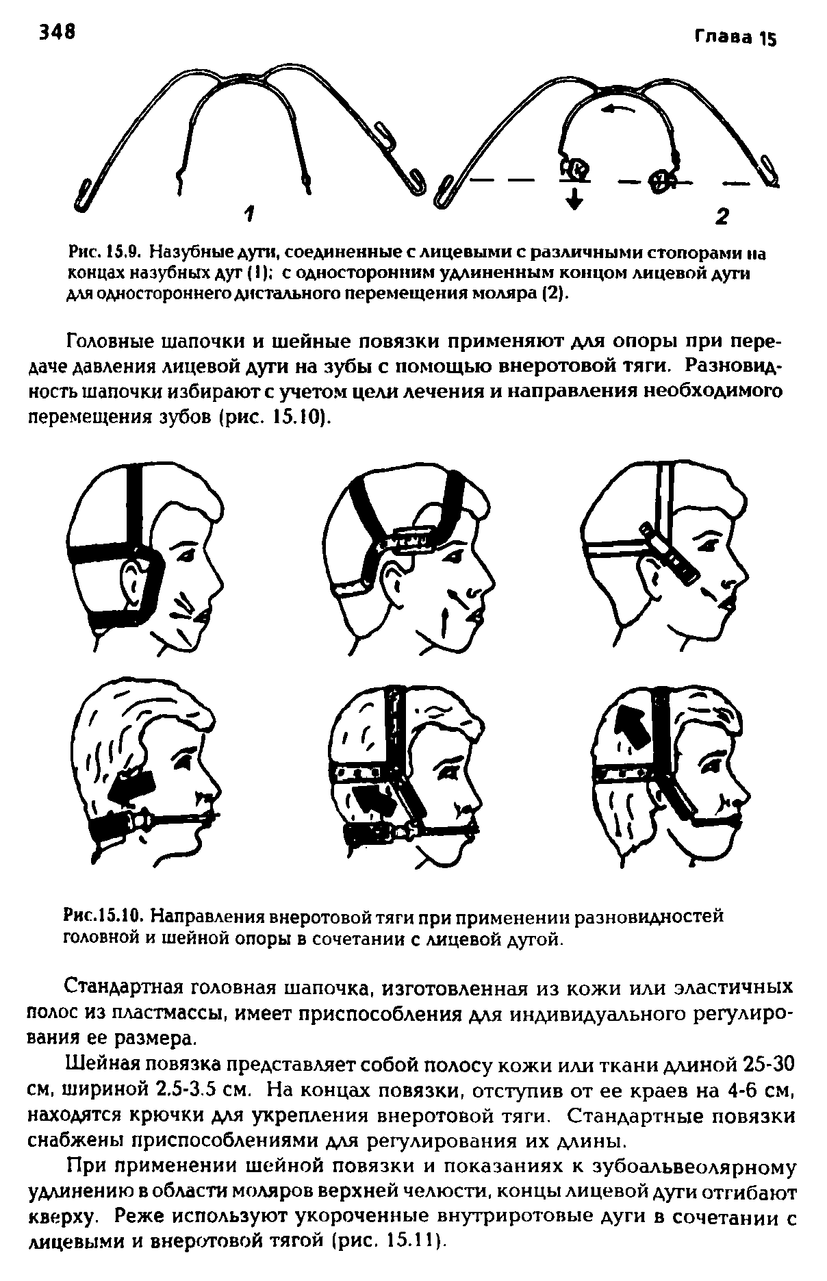 Рис.15.10. Направления внеротовой тяги при применении разновидностей головной и шейной опоры в сочетании с лицевой дугой.