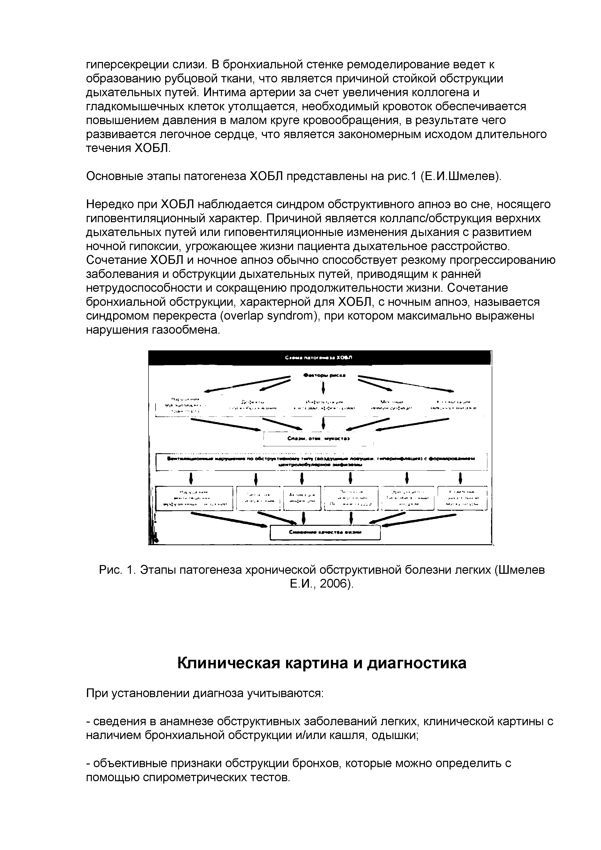 Рис. 1. Этапы патогенеза хронической обструктивной болезни легких (Шмелев Е.И., 2006).